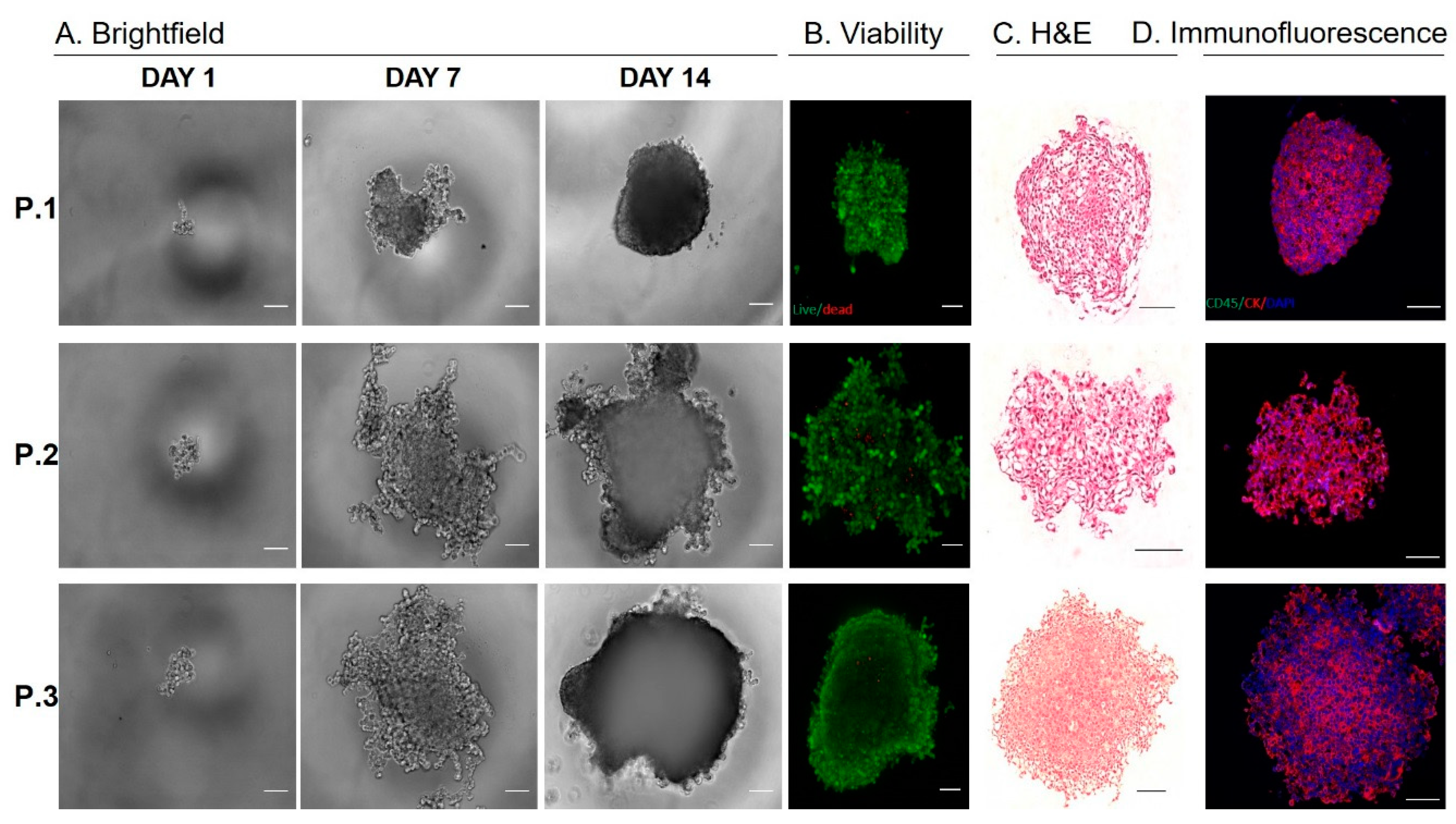 Cancers 12 01011 g004 Cancers 12 01011 g004