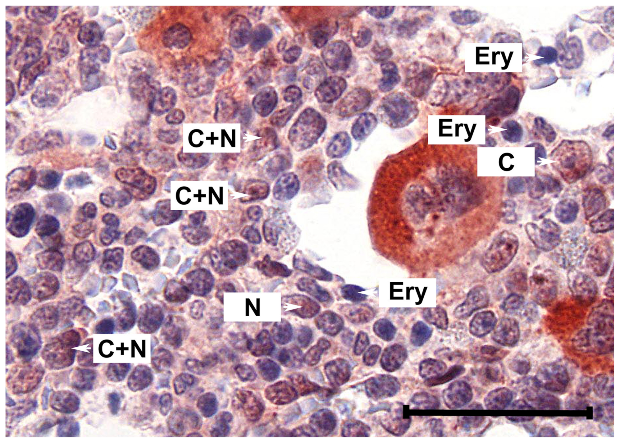 Cancers 12 01021 g0a1