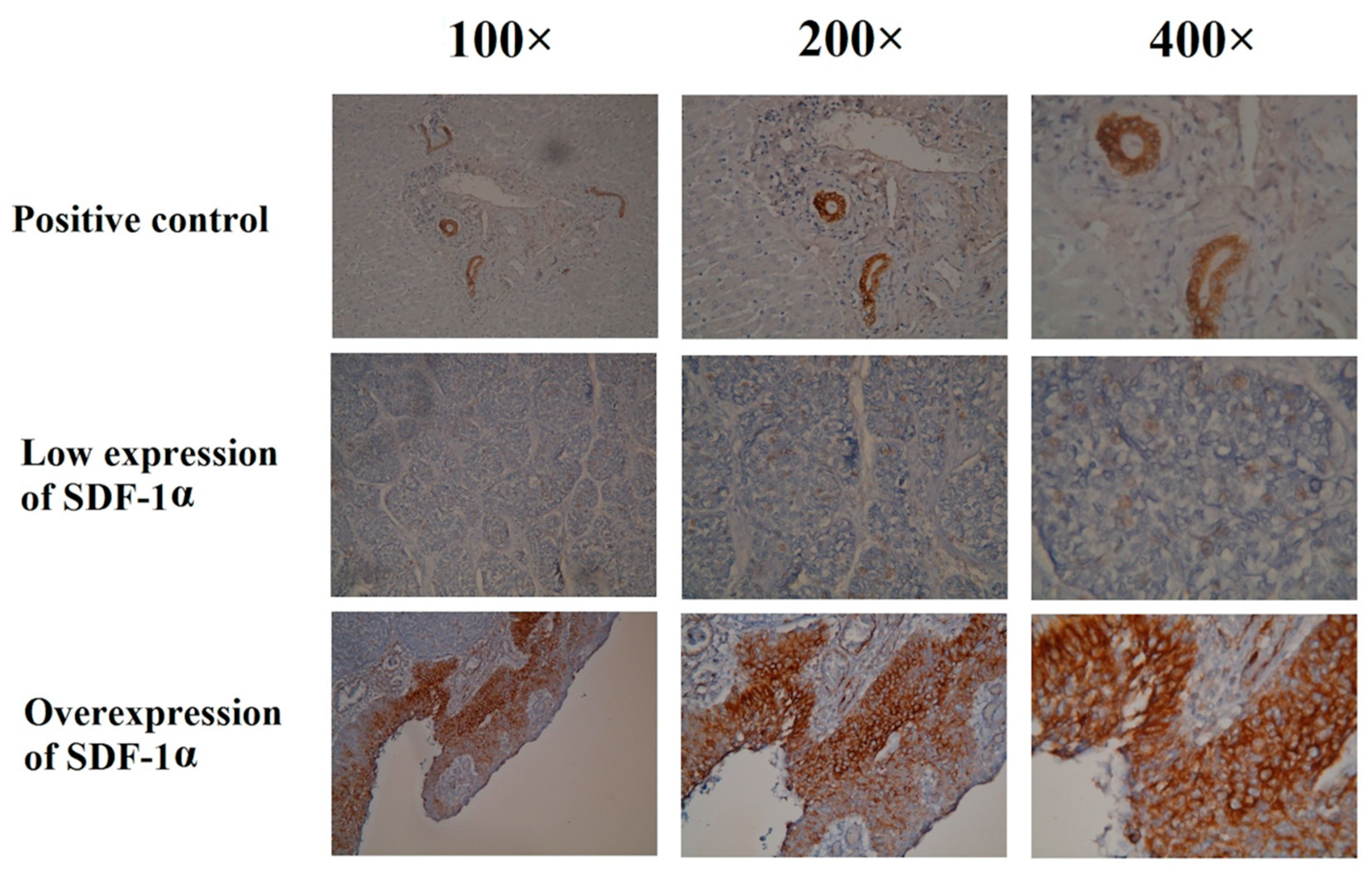 Cancers 12 01067 g001 Cancers 12 01067 g001