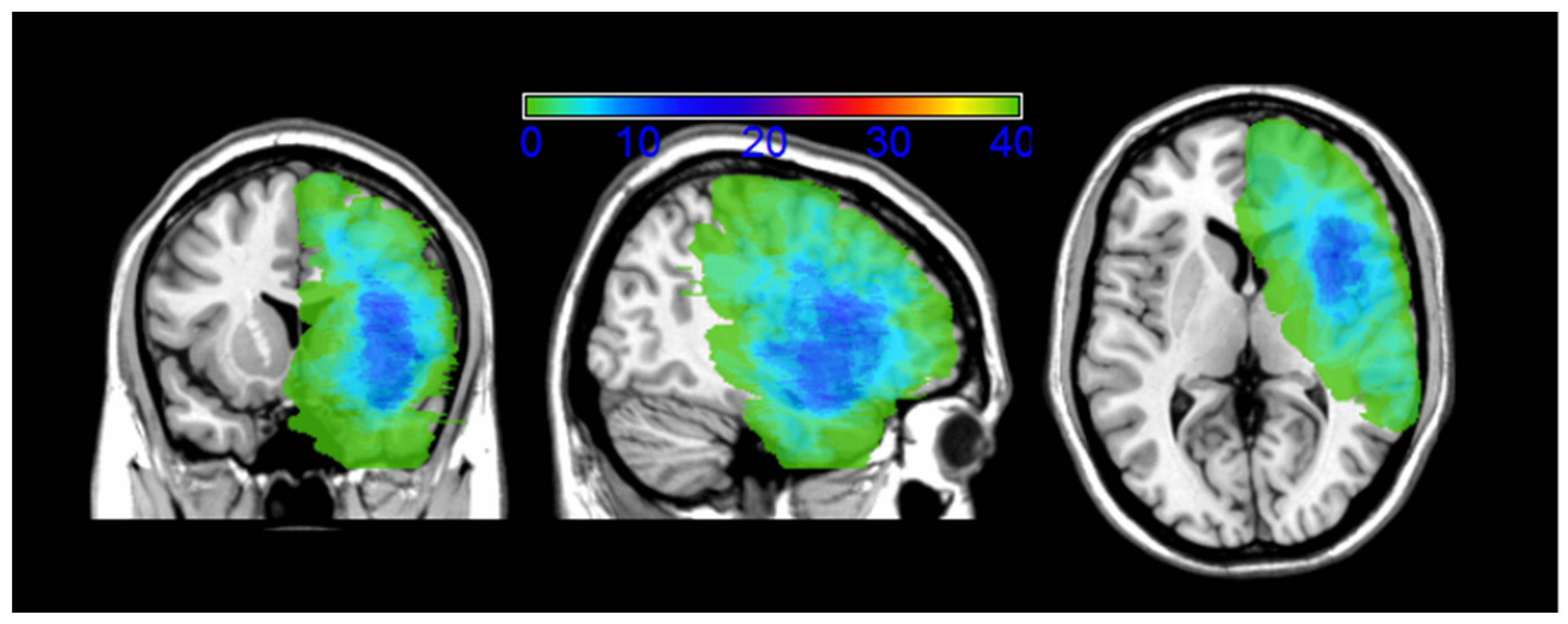 Cancers 12 01077 g001