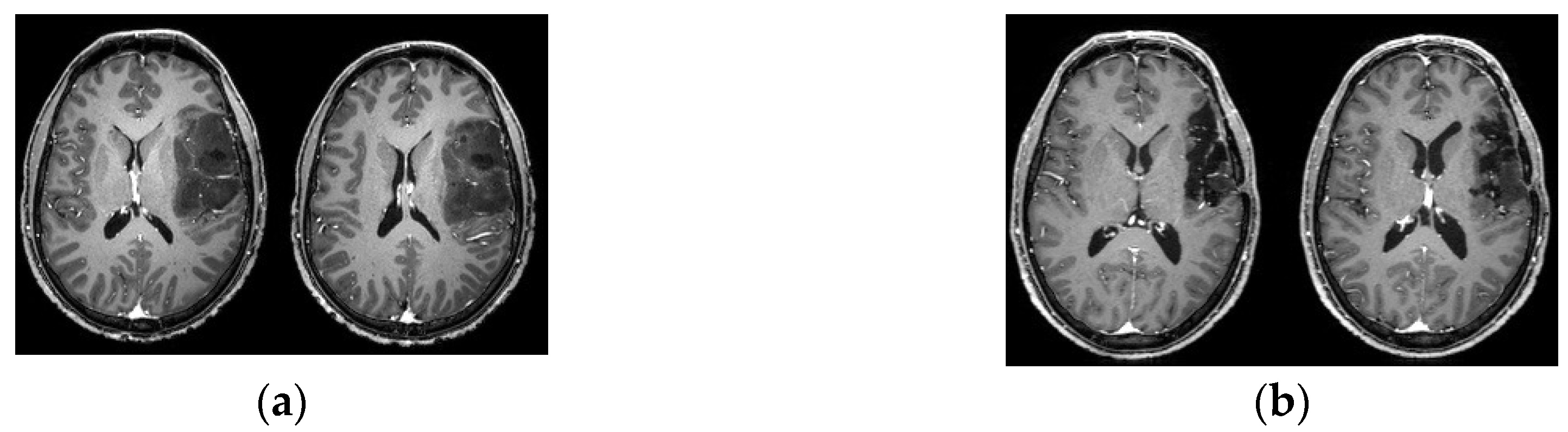 Cancers 12 01077 g002