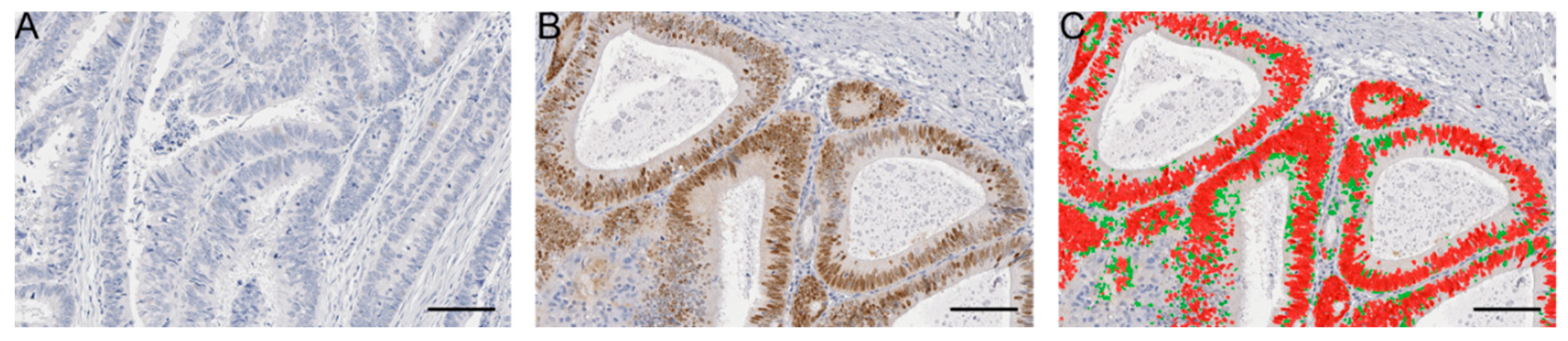 Cancers 12 01110 g001