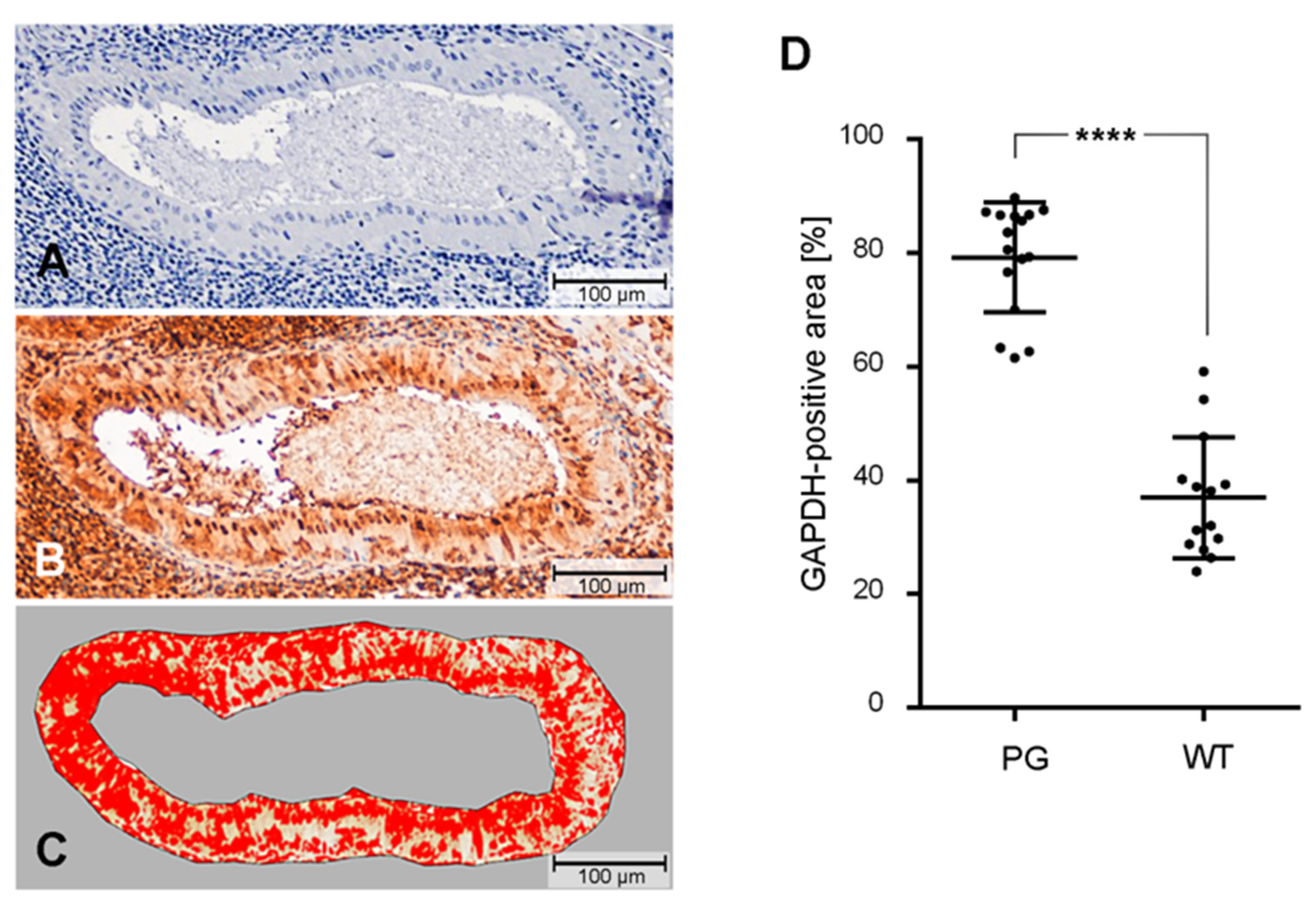 Cancers 12 01112 g003