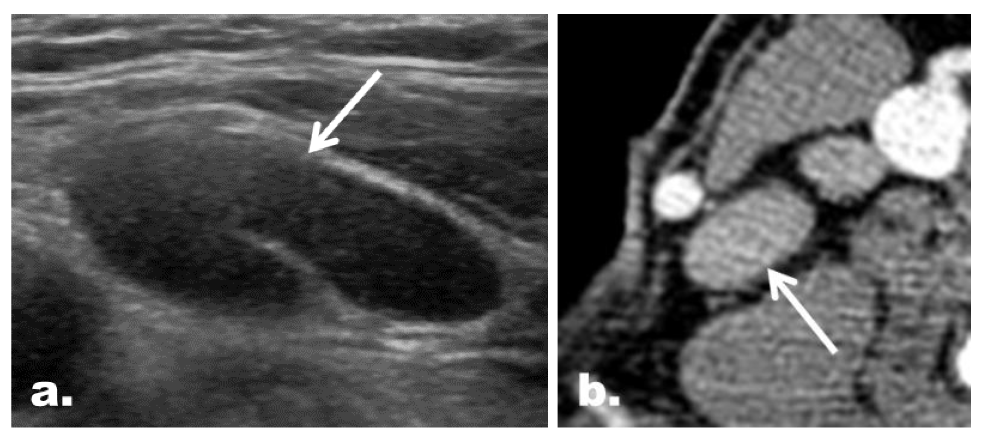 Cancers 12 01190 g005