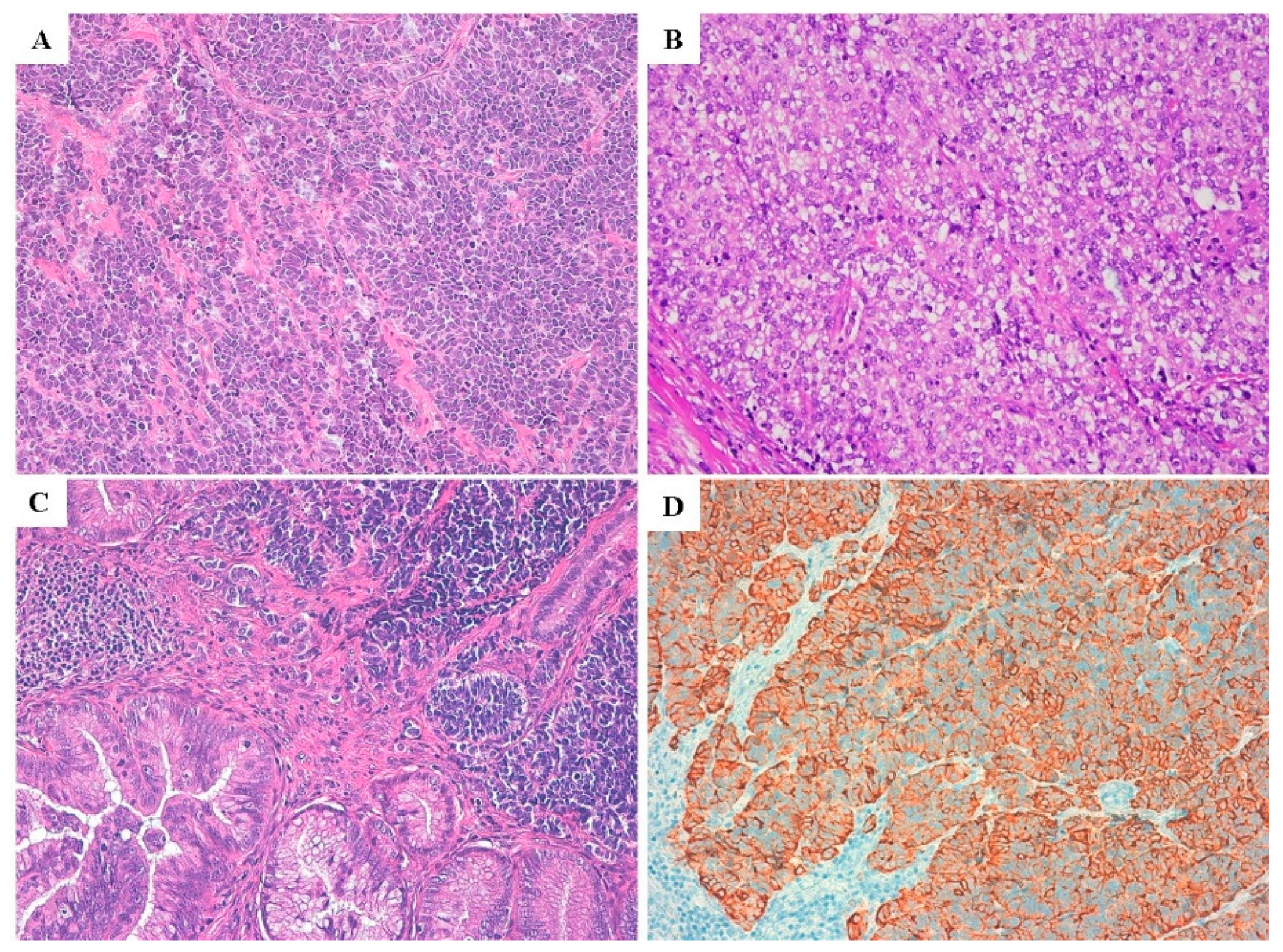 Cancers 12 01211 g001