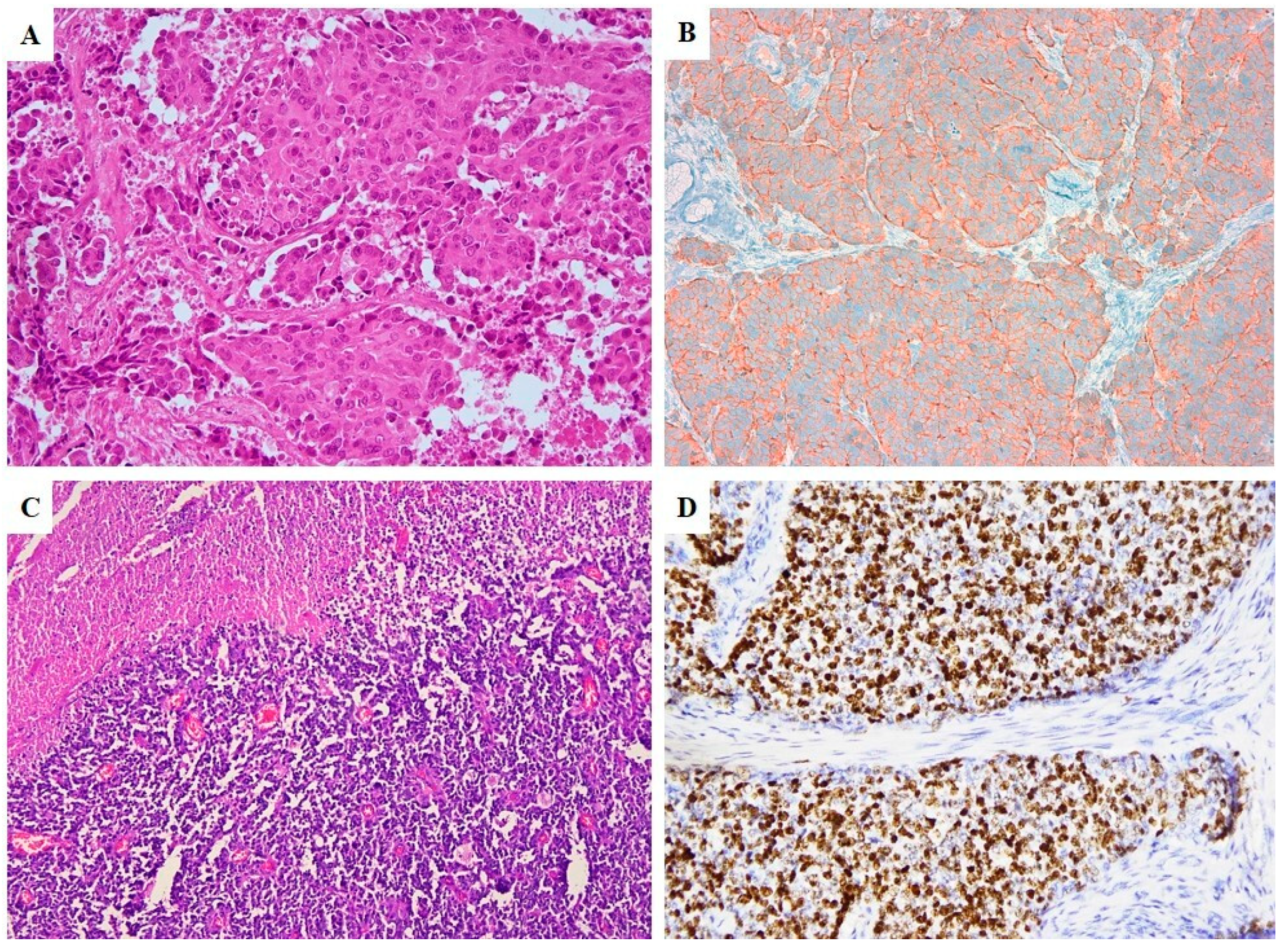 Cancers 12 01211 g002