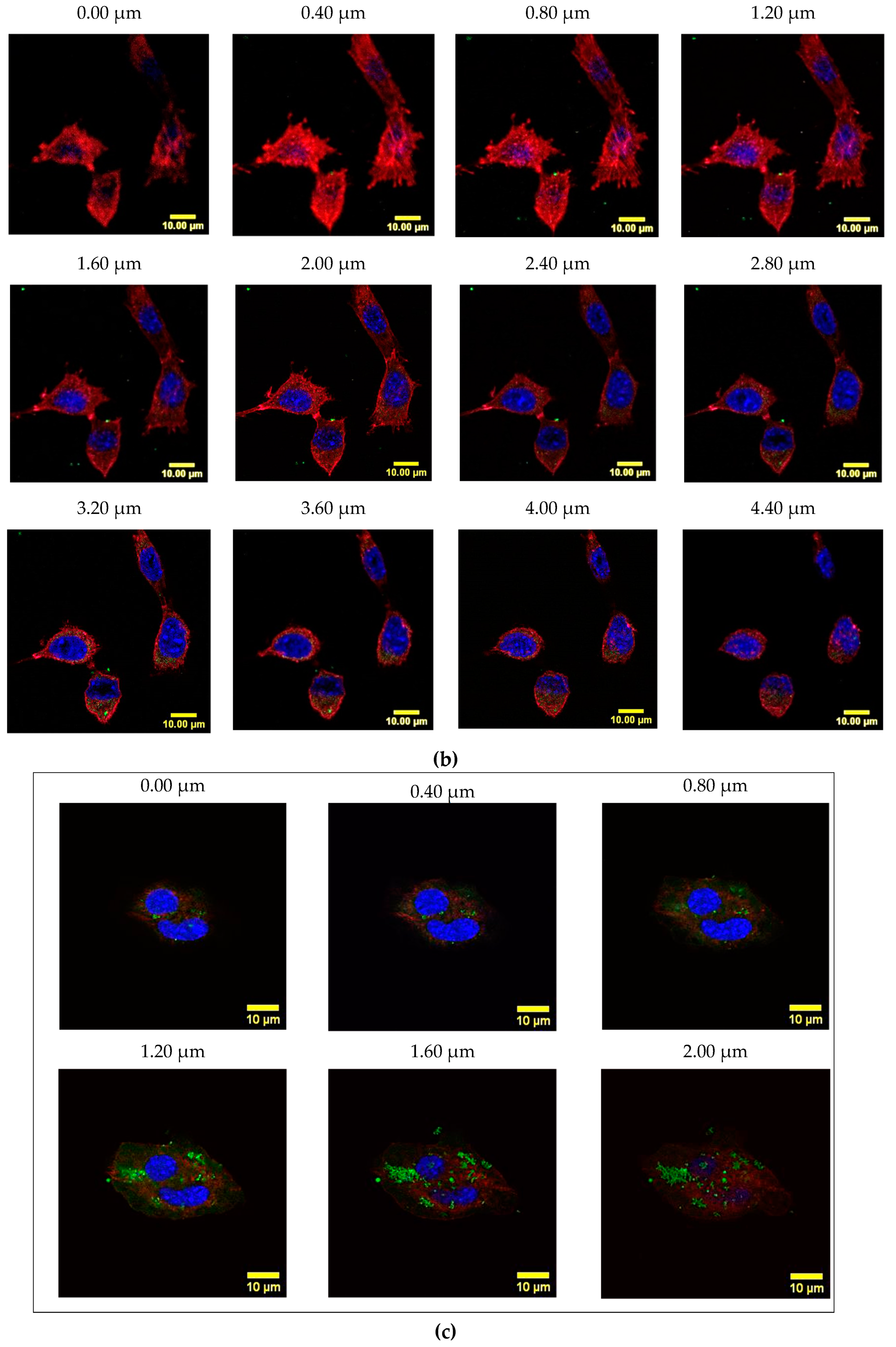 Cancers 12 01215 g011b