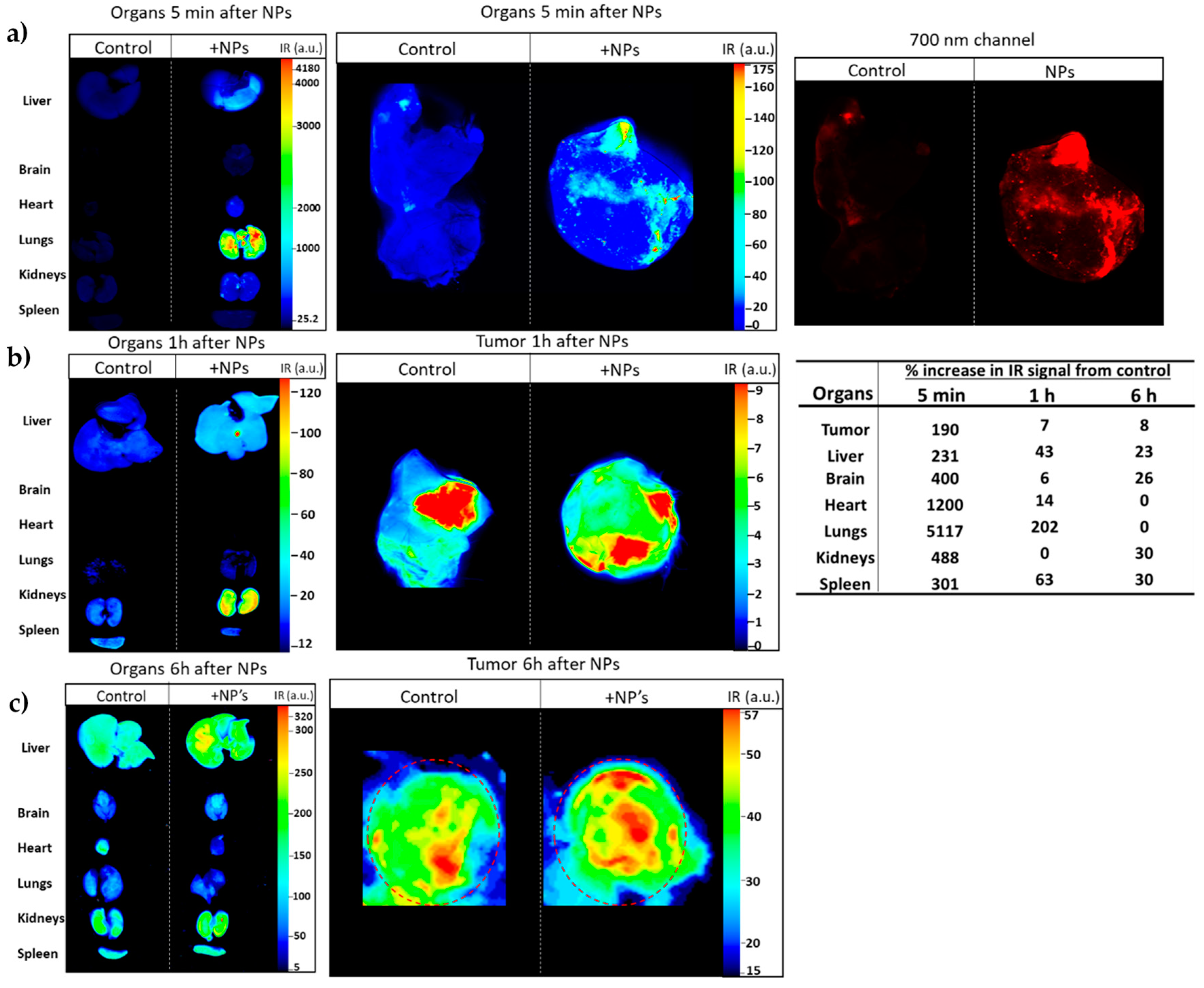 Cancers 12 01215 g013