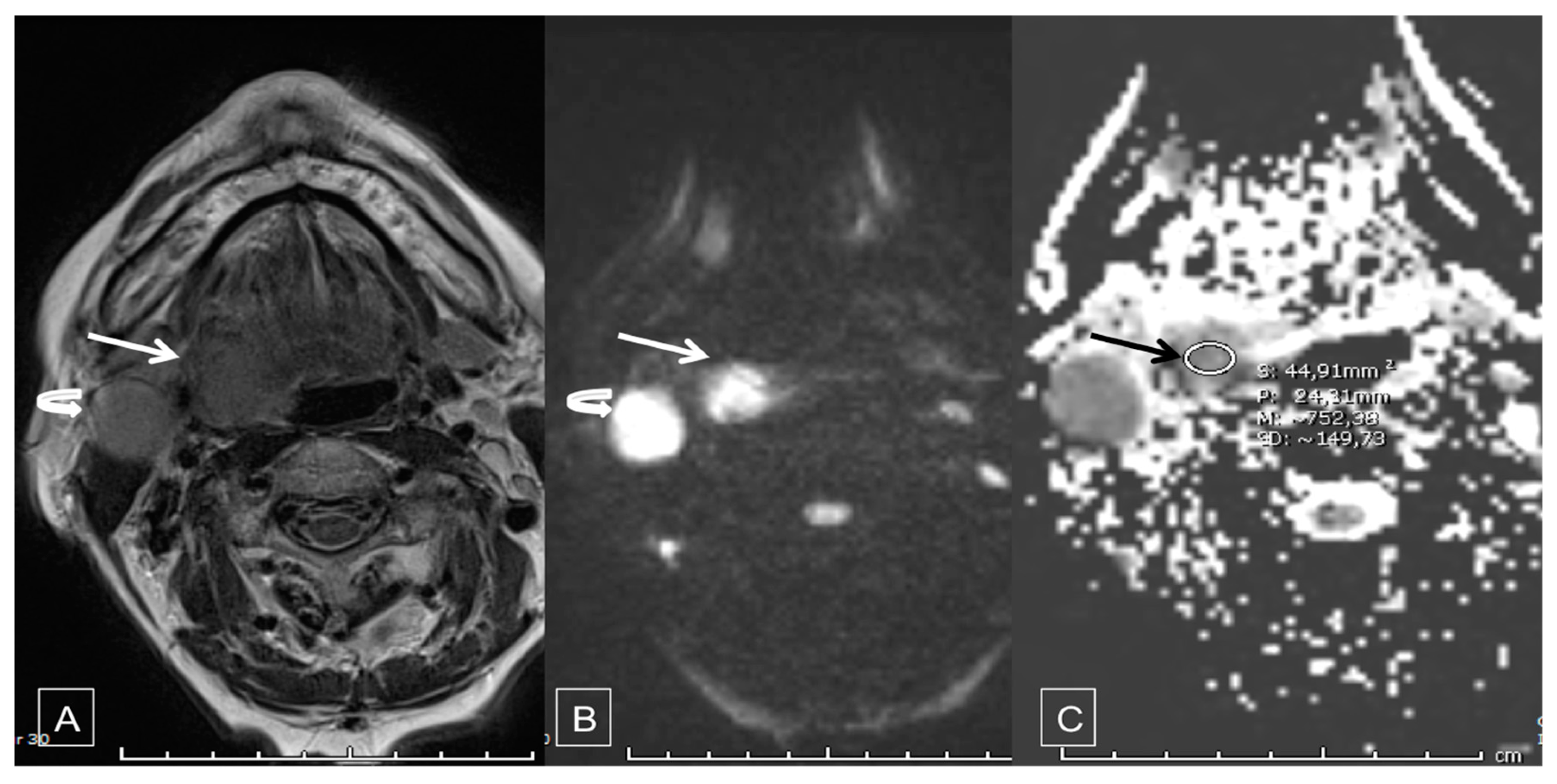 Cancers 12 01234 g001
