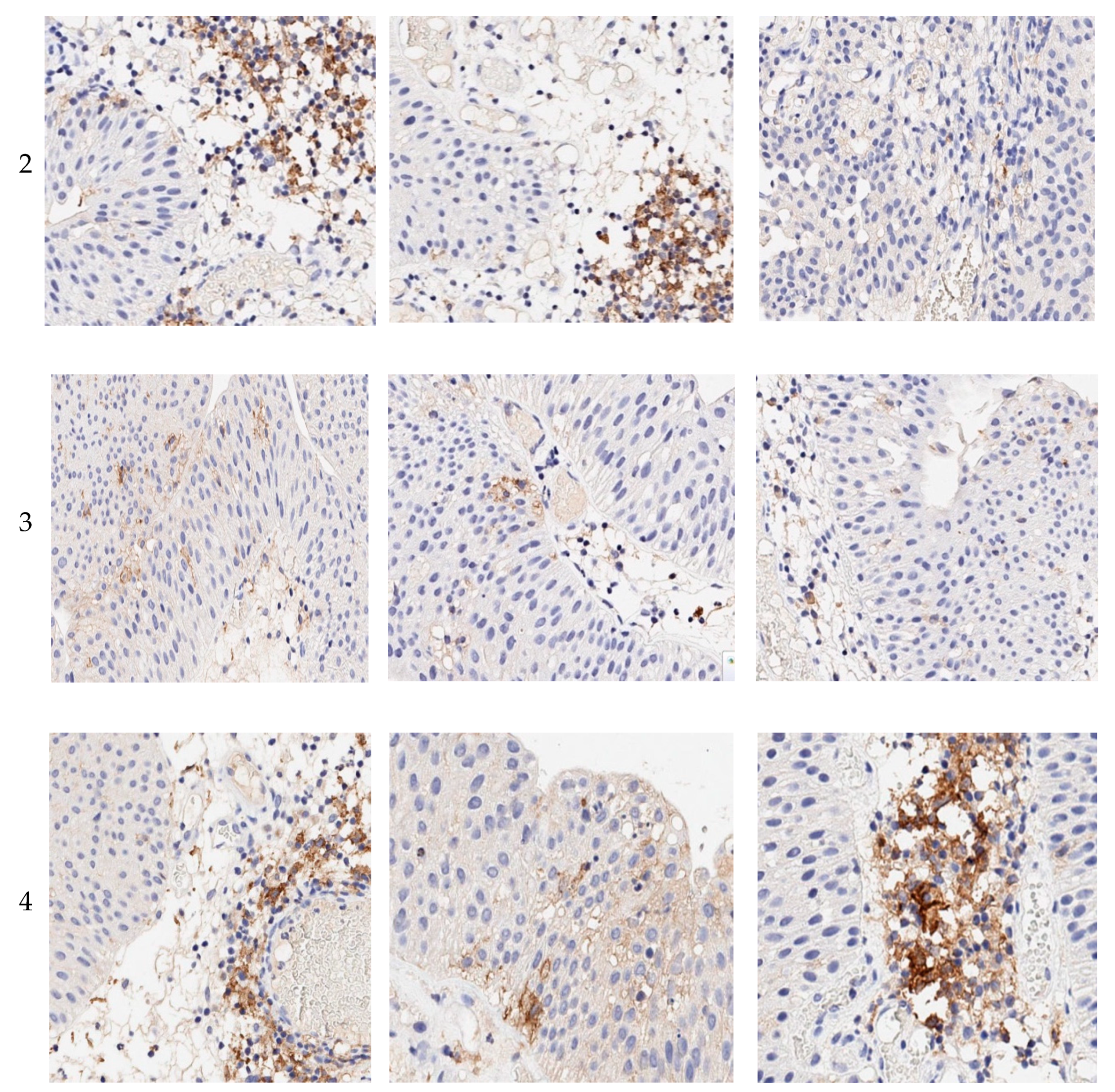 Cancers 12 01316 g001b