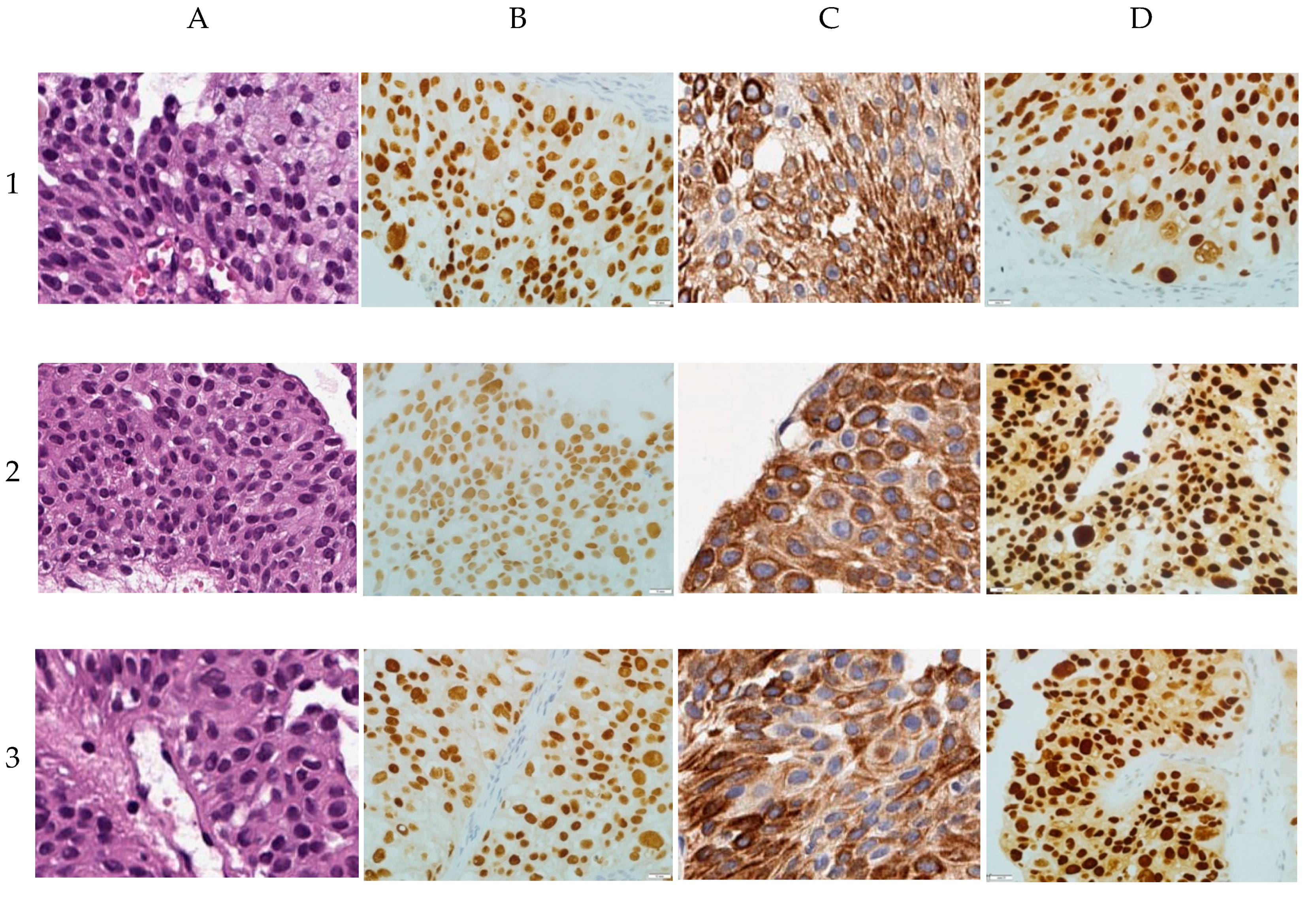 Cancers 12 01316 g0a1a