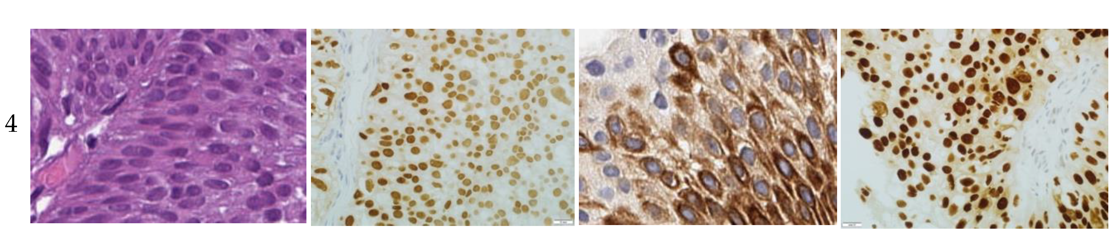 Cancers 12 01316 g0a1b