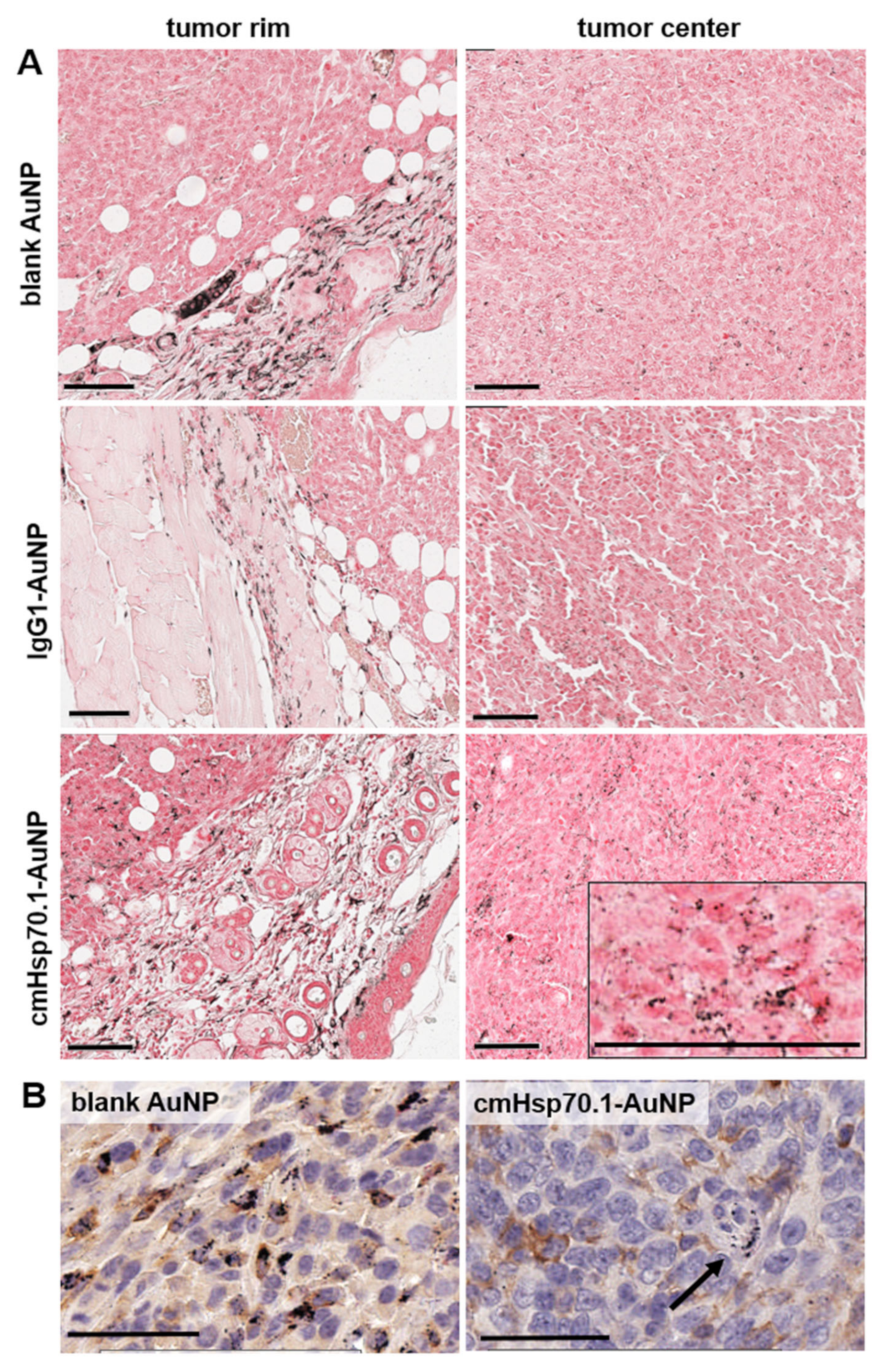 Cancers 12 01331 g007