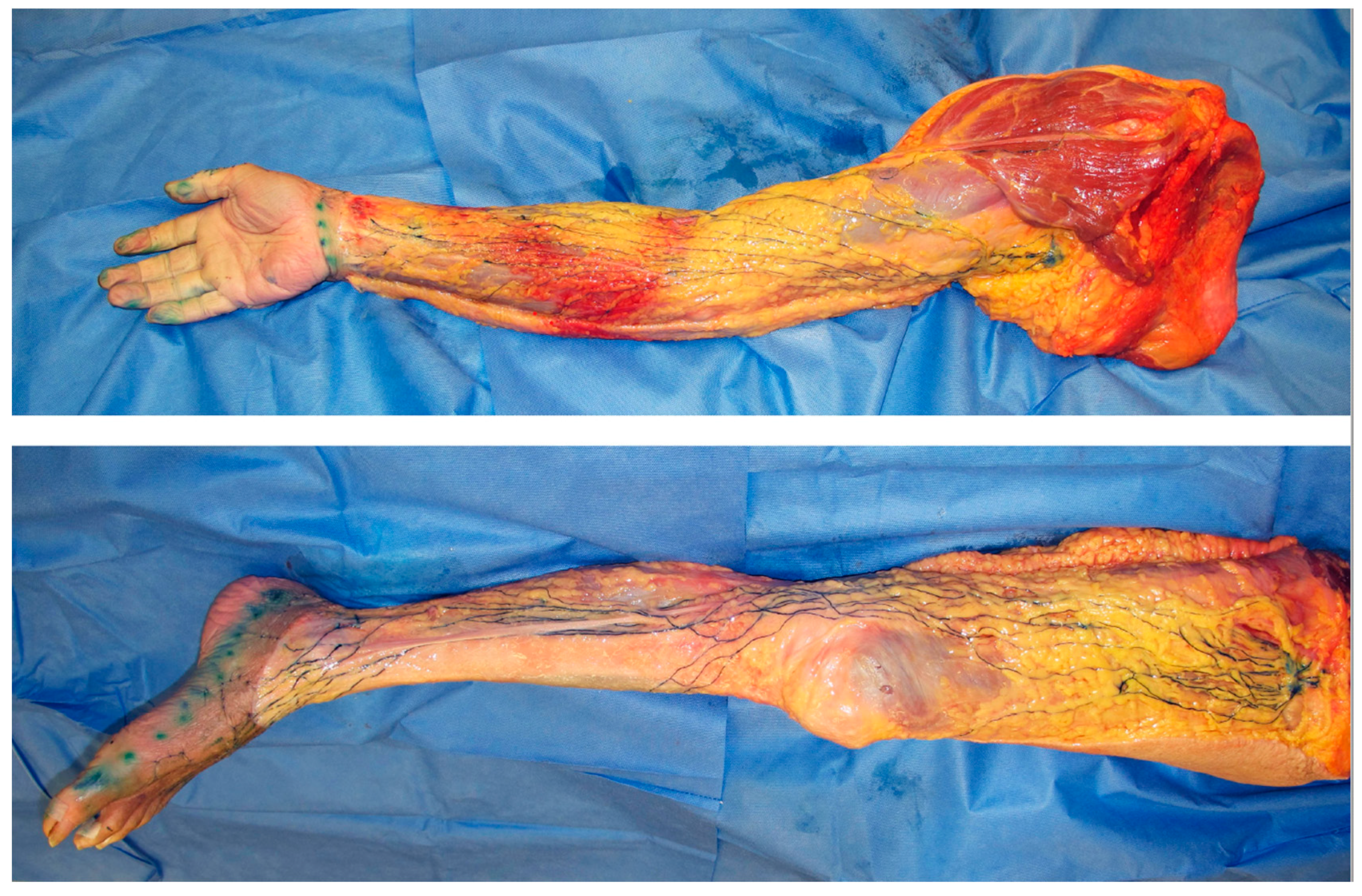 Cancers 12 01338 g002 Cancers 12 01338 g002