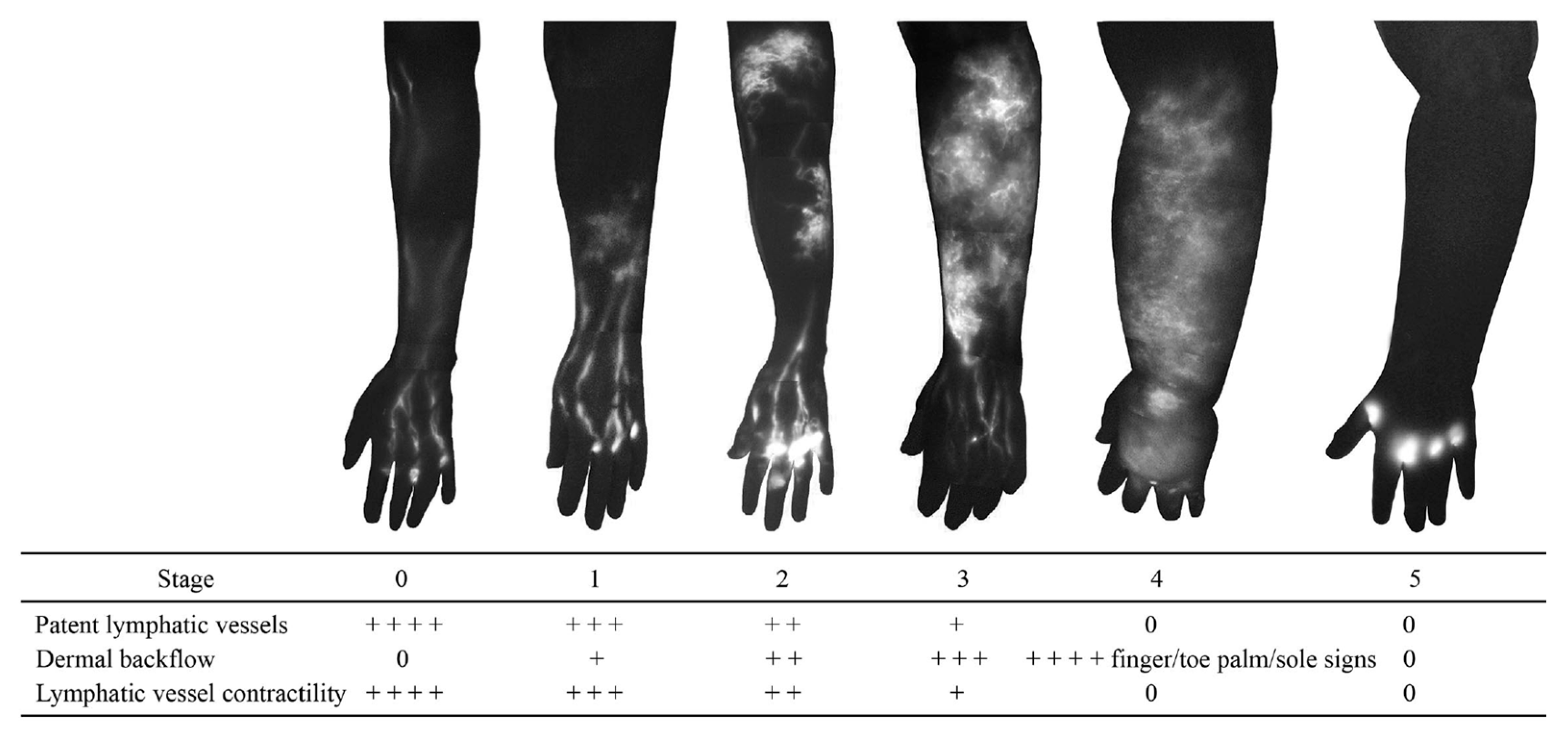 Cancers 12 01338 g004 Cancers 12 01338 g004