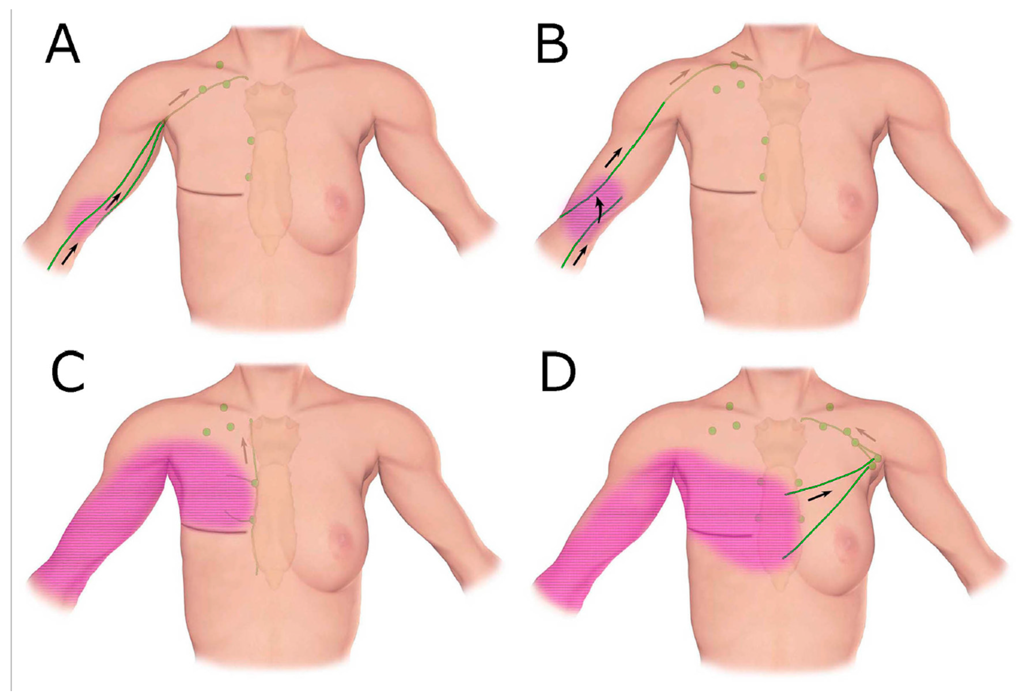 Cancers 12 01338 g007 Cancers 12 01338 g007