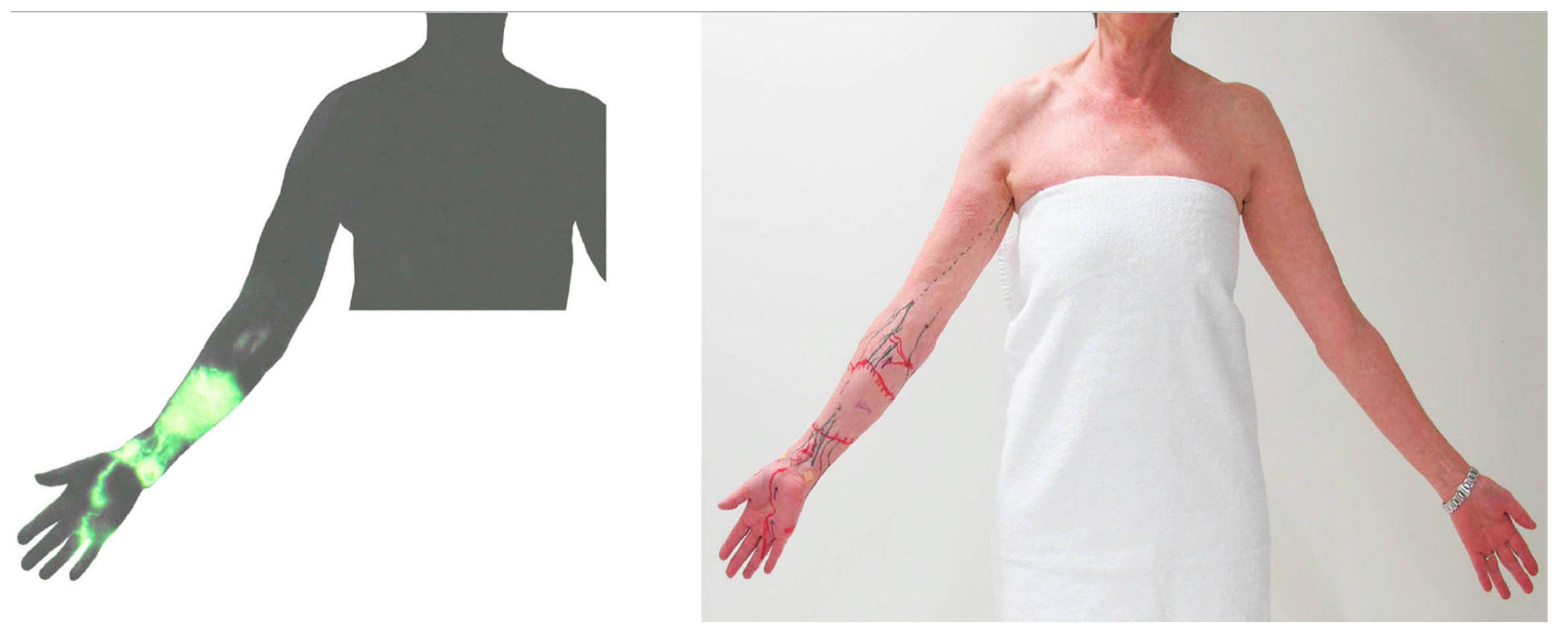 Cancers 12 01338 g008 Cancers 12 01338 g008