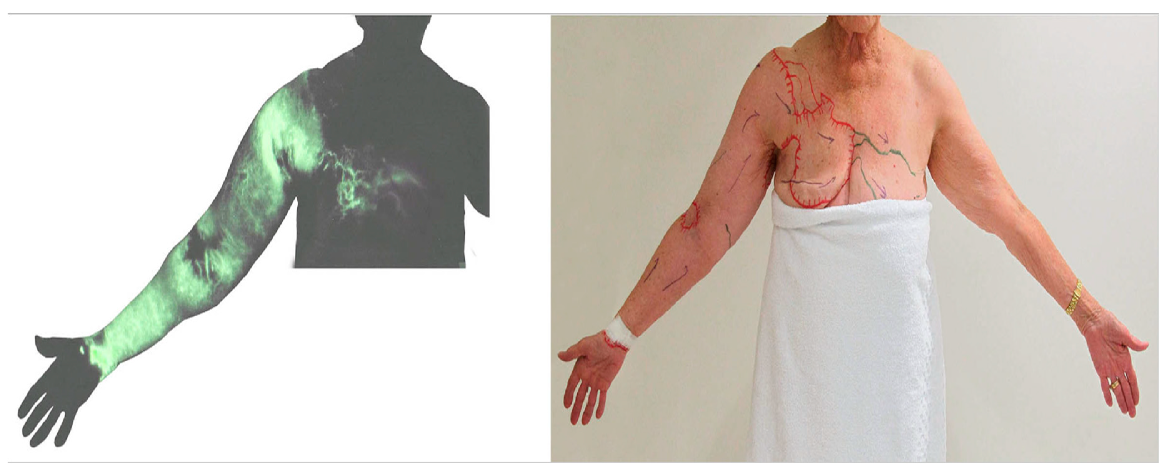 Cancers 12 01338 g009 Cancers 12 01338 g009