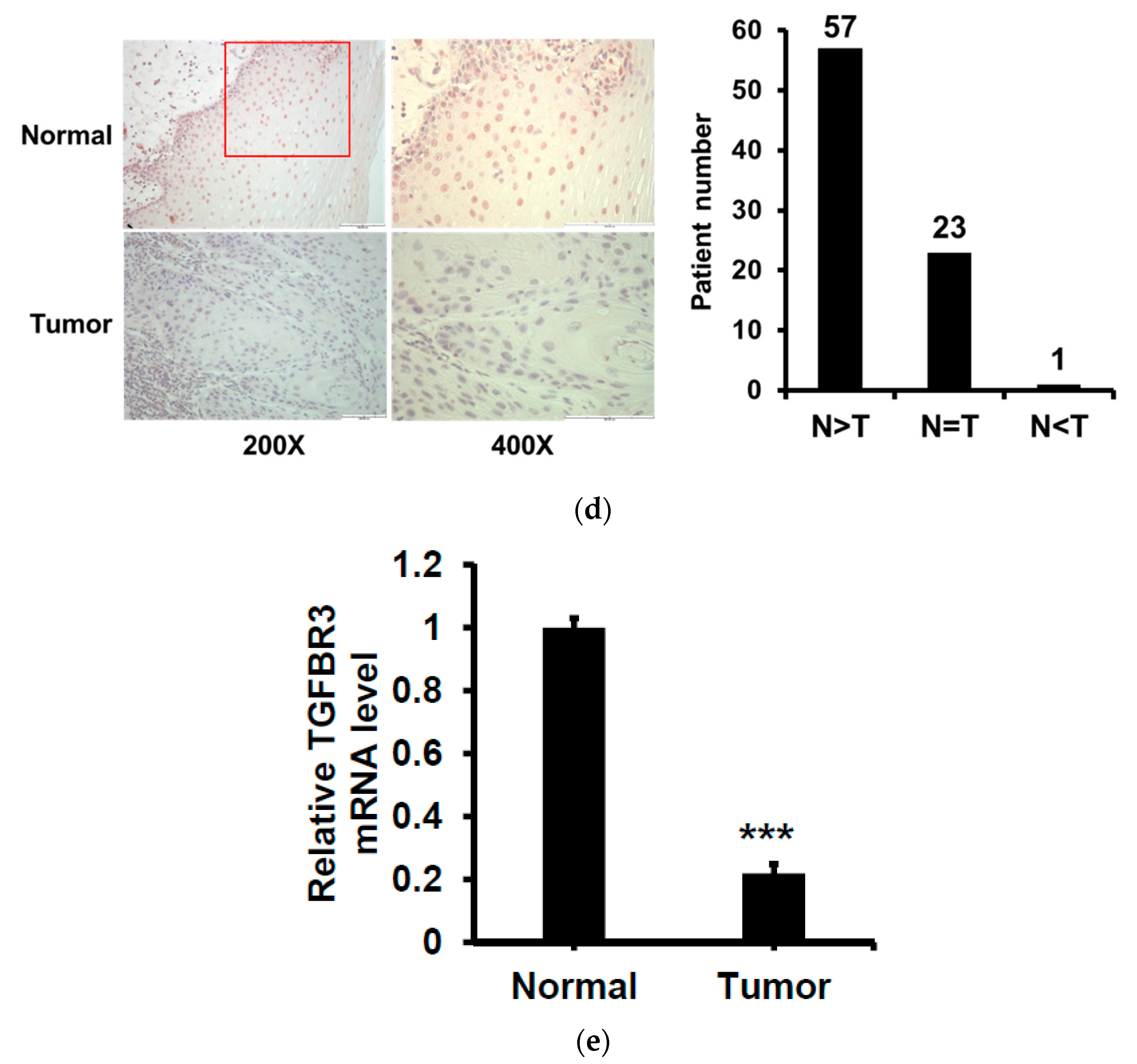 Cancers 12 01375 g001b