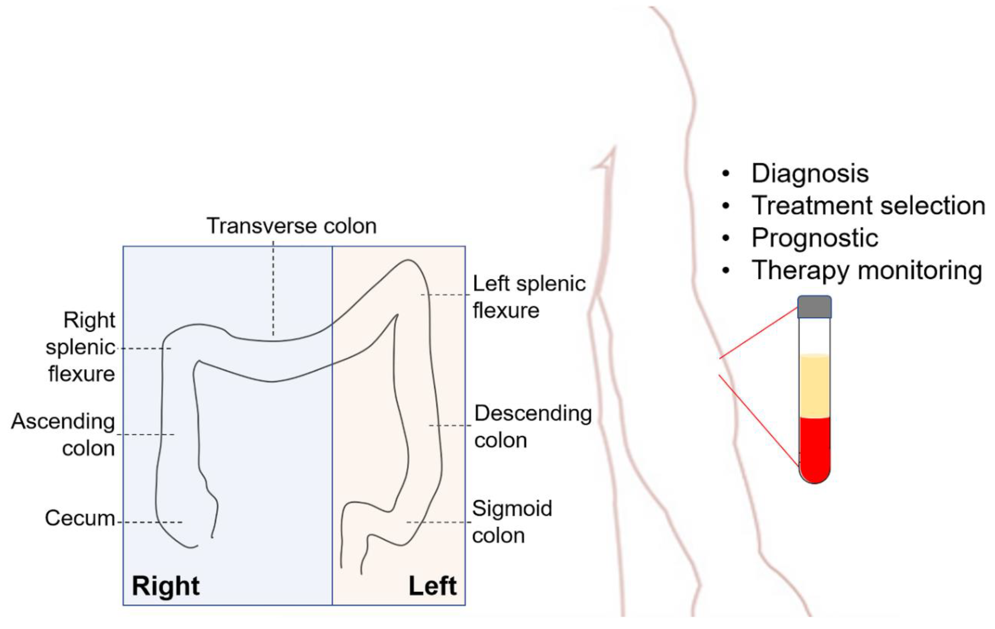 Cancers 12 01376 g001