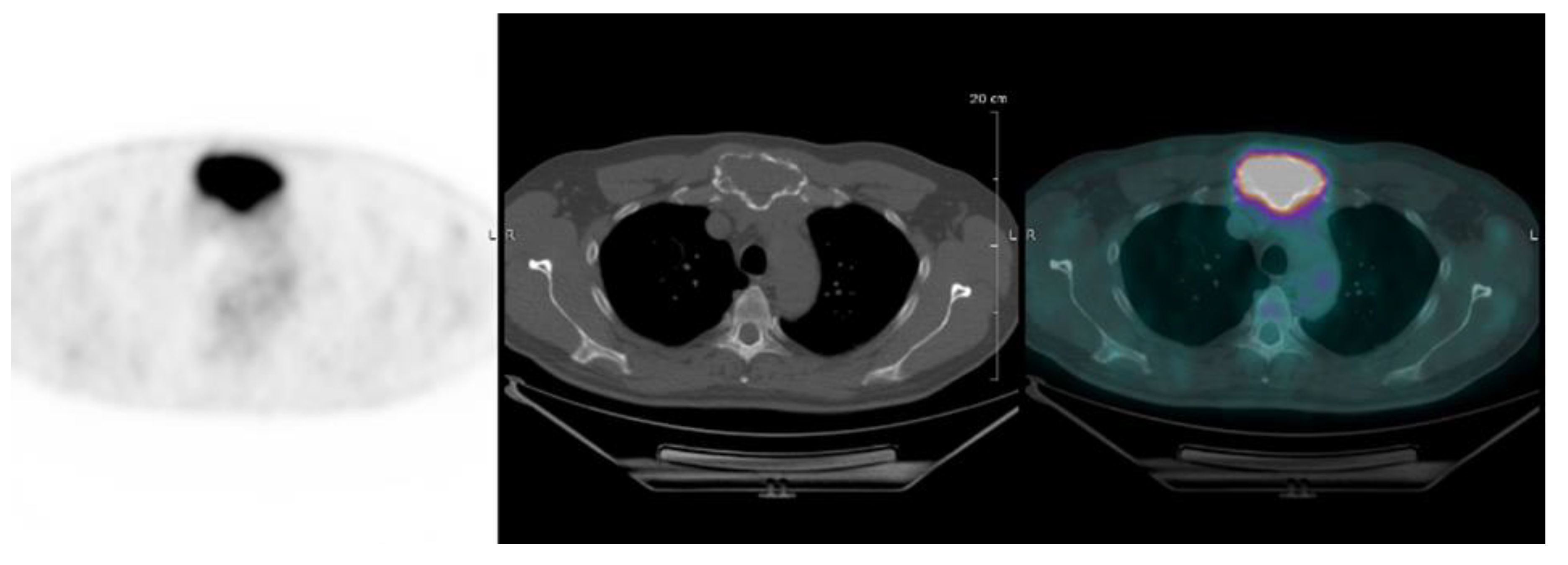 Cancers 12 01384 g001