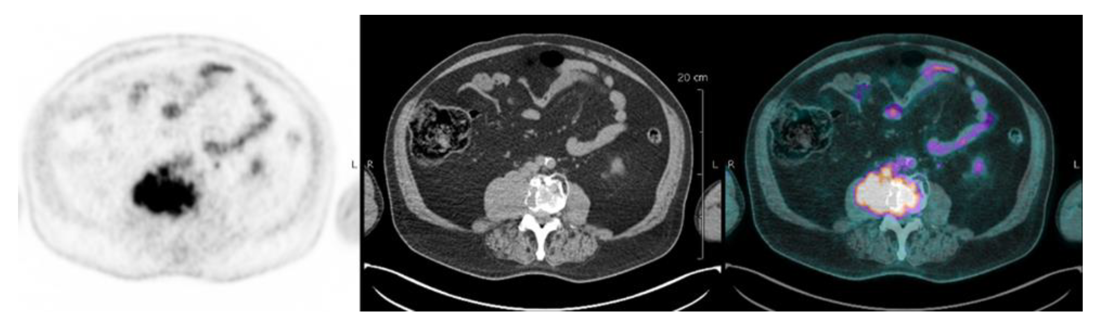 Cancers 12 01384 g002