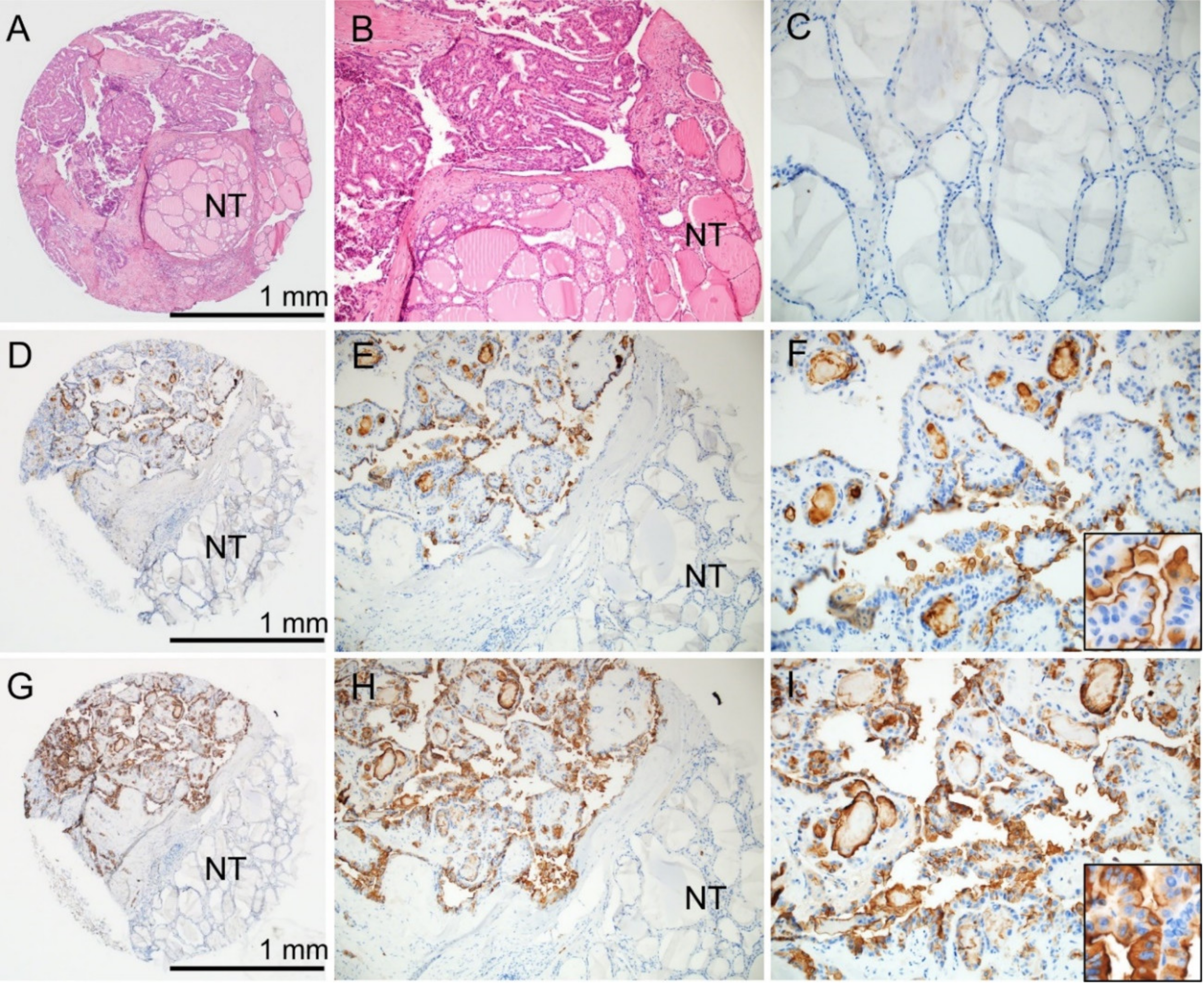 Cancers 12 01413 g001