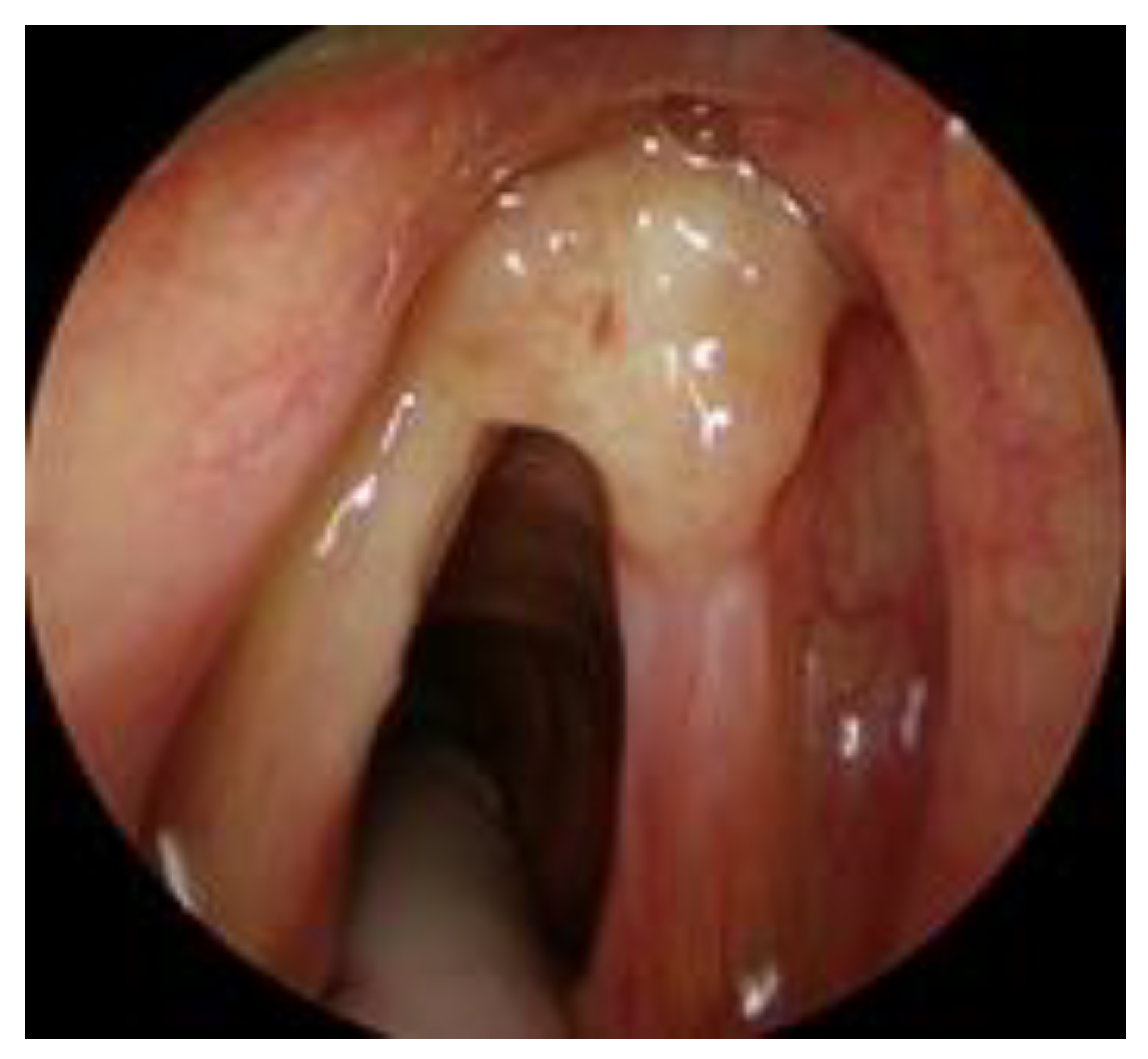 Cancers 12 01485 g003