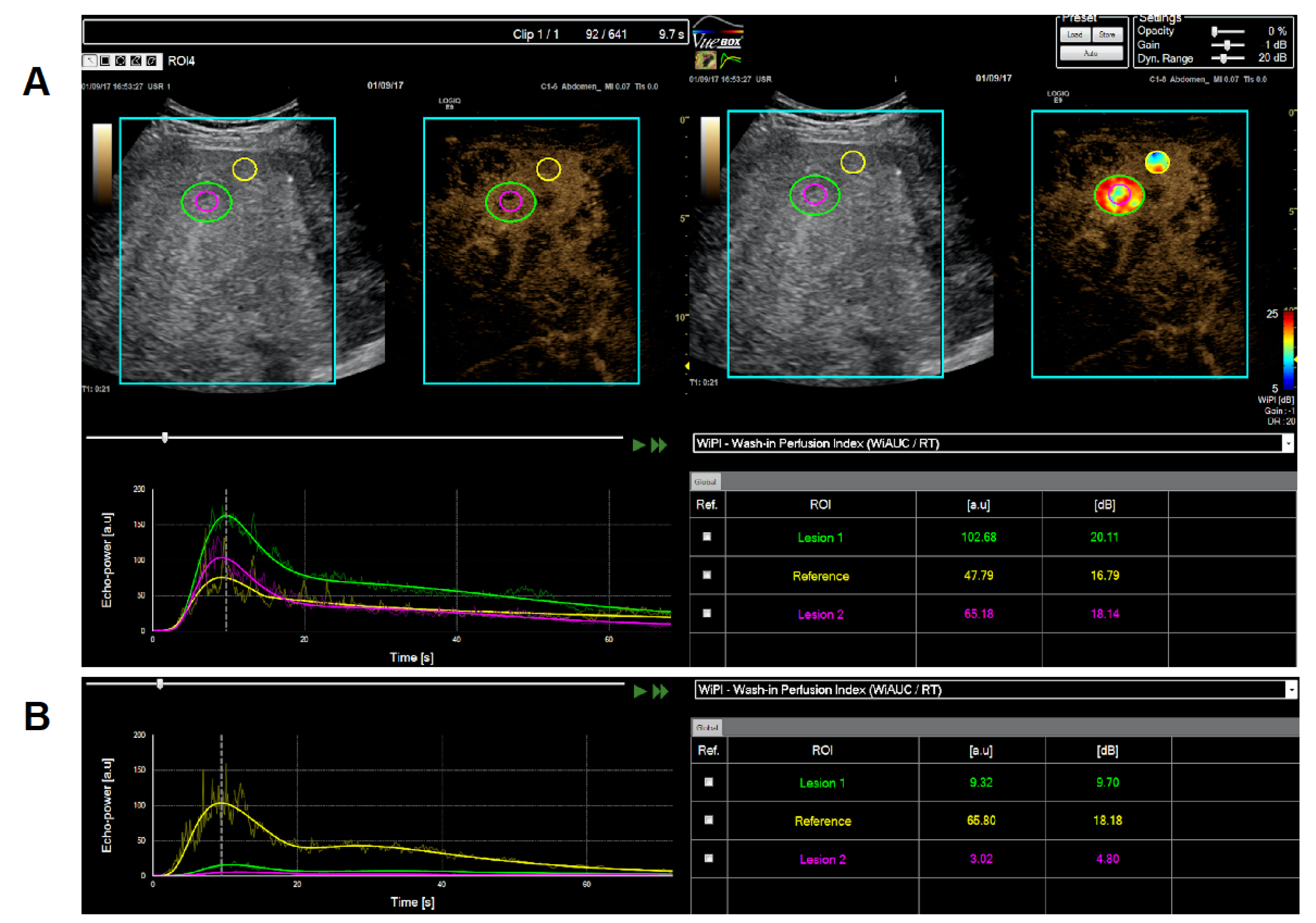 Cancers 12 01488 g002