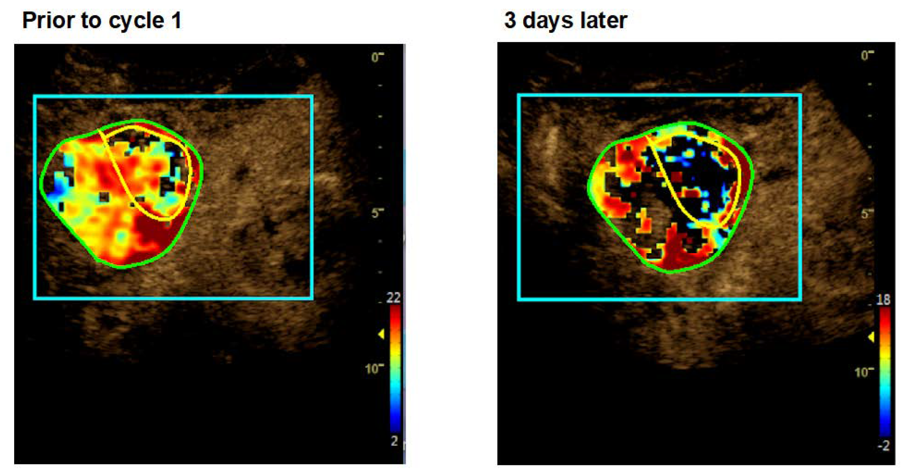 Cancers 12 01488 g003