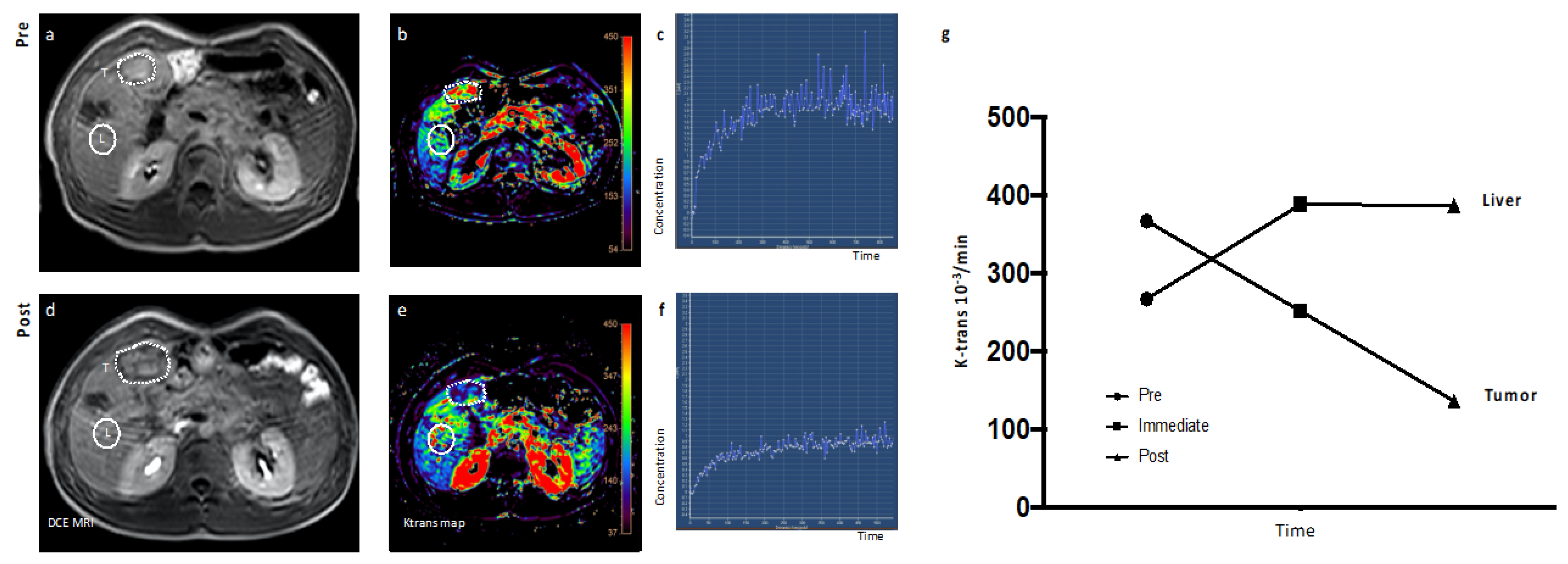 Cancers 12 01488 g004