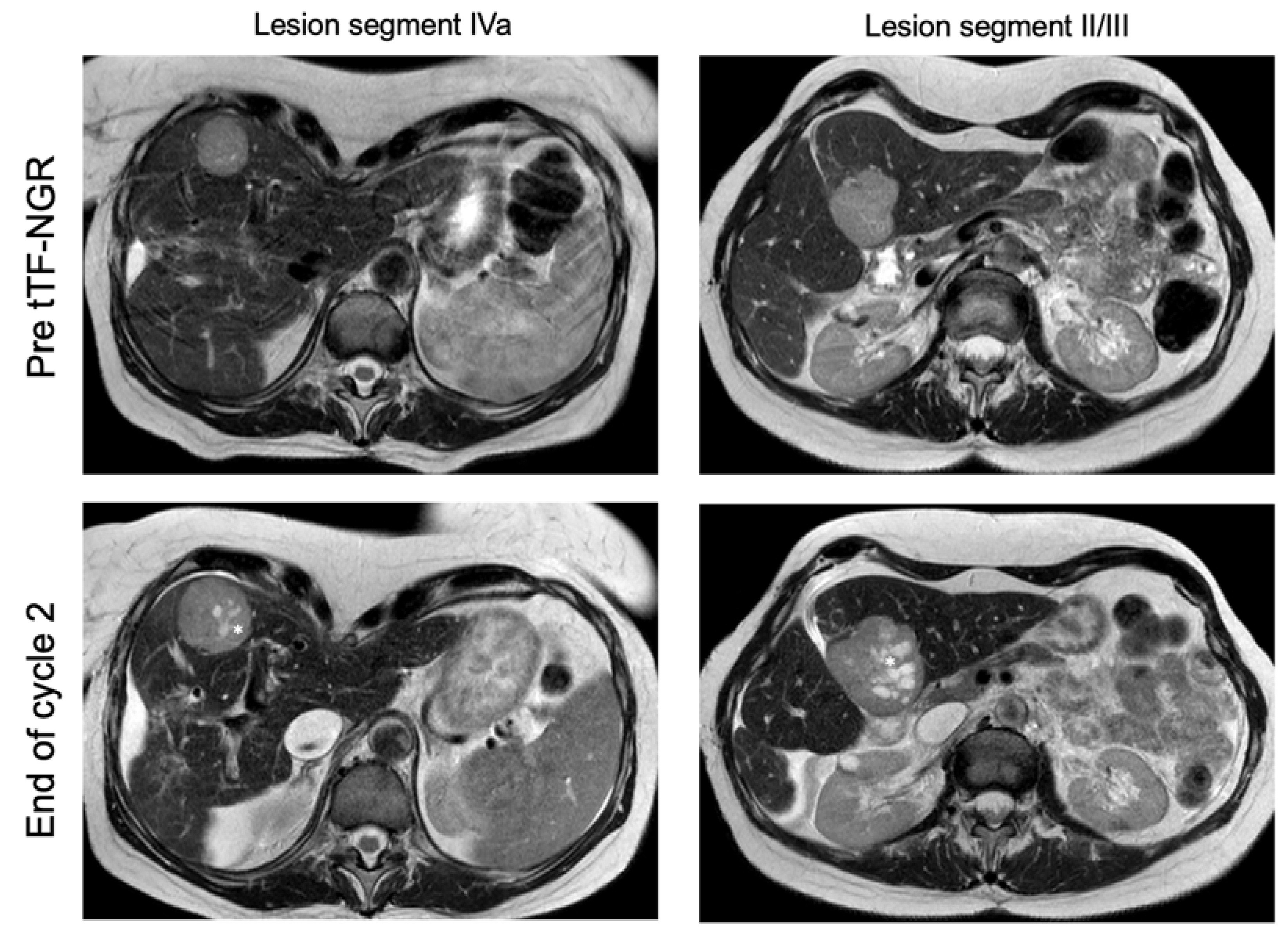 Cancers 12 01488 g006