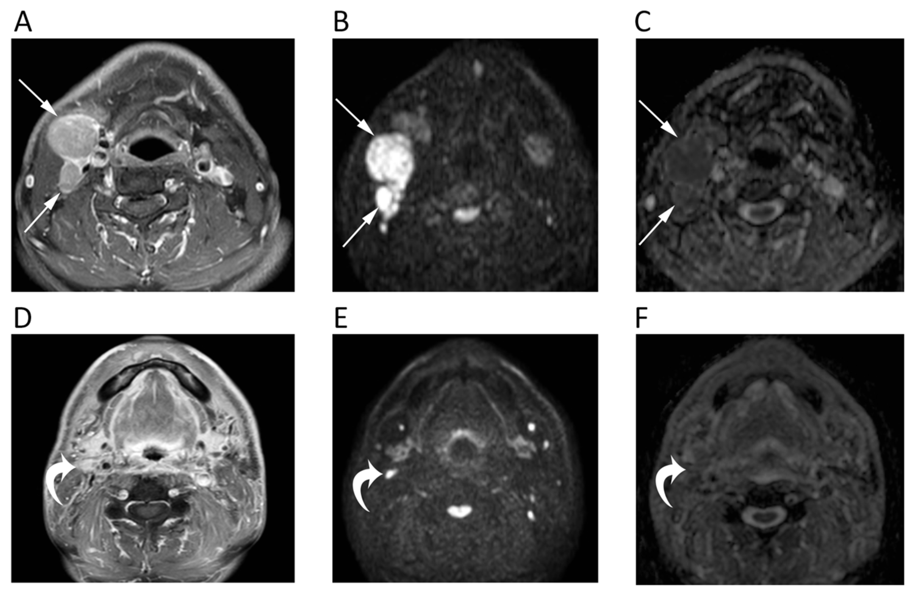 Cancers 12 01493 g002 Cancers 12 01493 g002