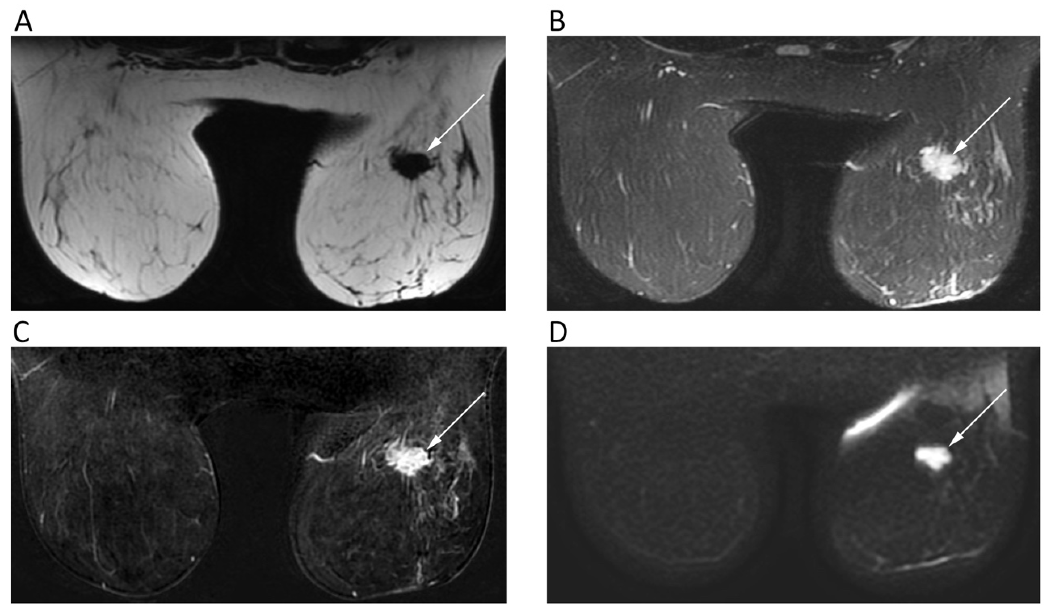 Cancers 12 01493 g004 Cancers 12 01493 g004