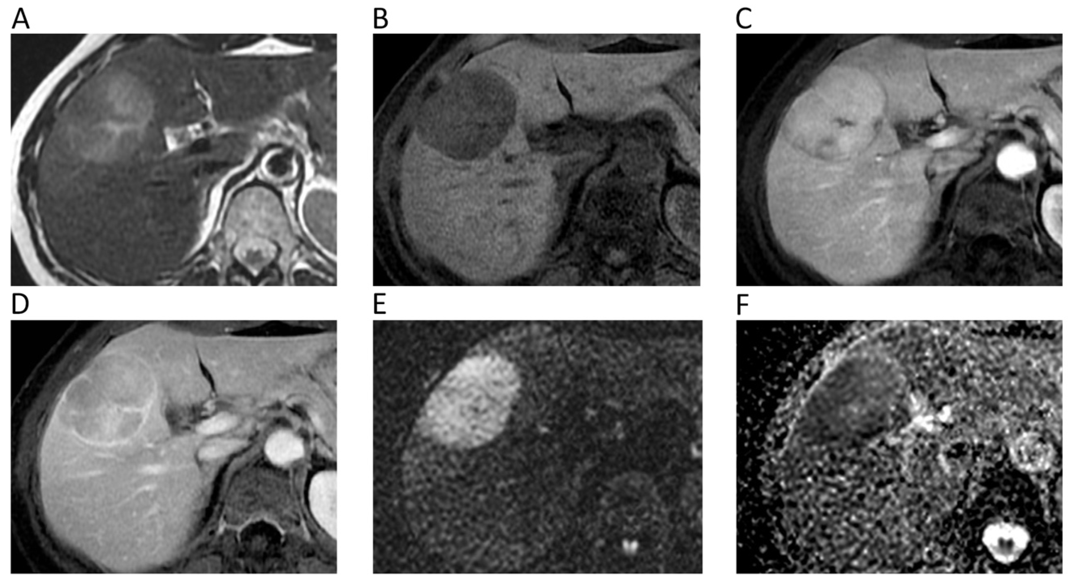 Cancers 12 01493 g005 Cancers 12 01493 g005