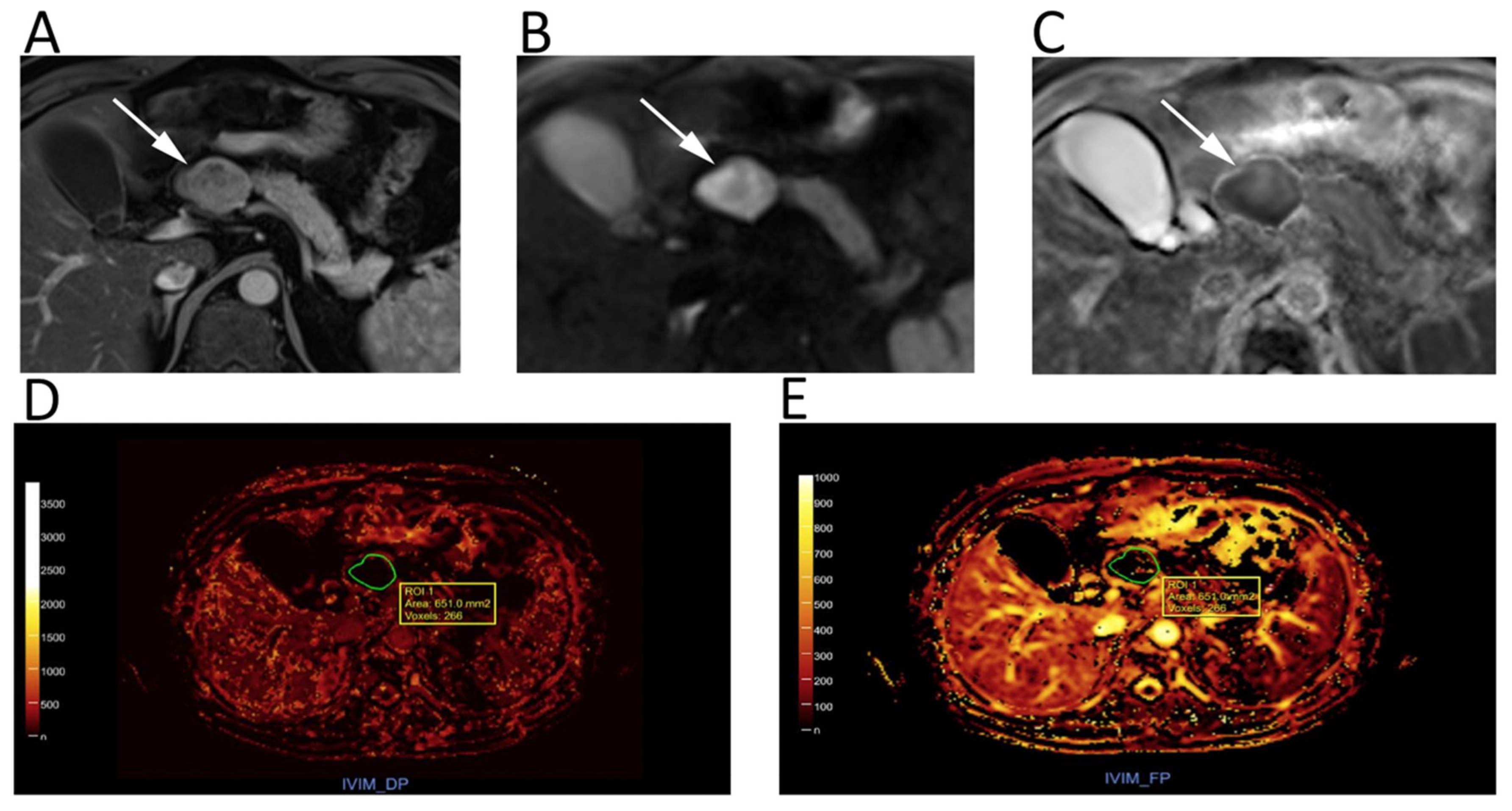 Cancers 12 01493 g006 Cancers 12 01493 g006