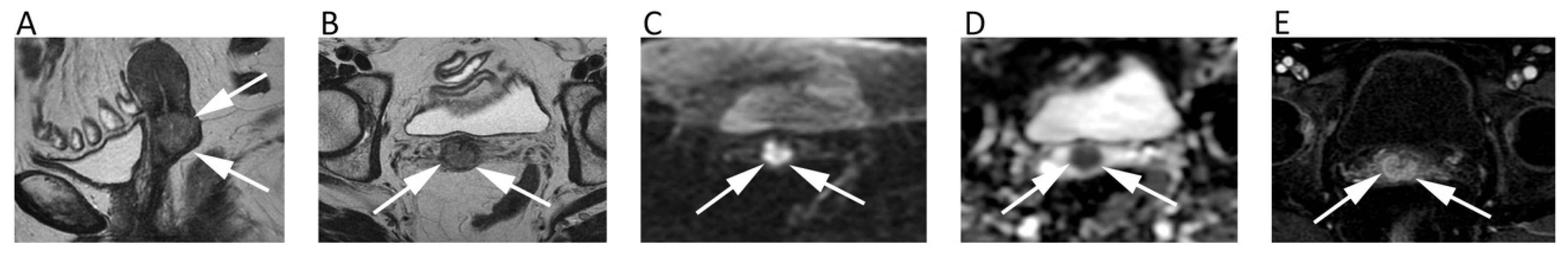 Cancers 12 01493 g008 Cancers 12 01493 g008