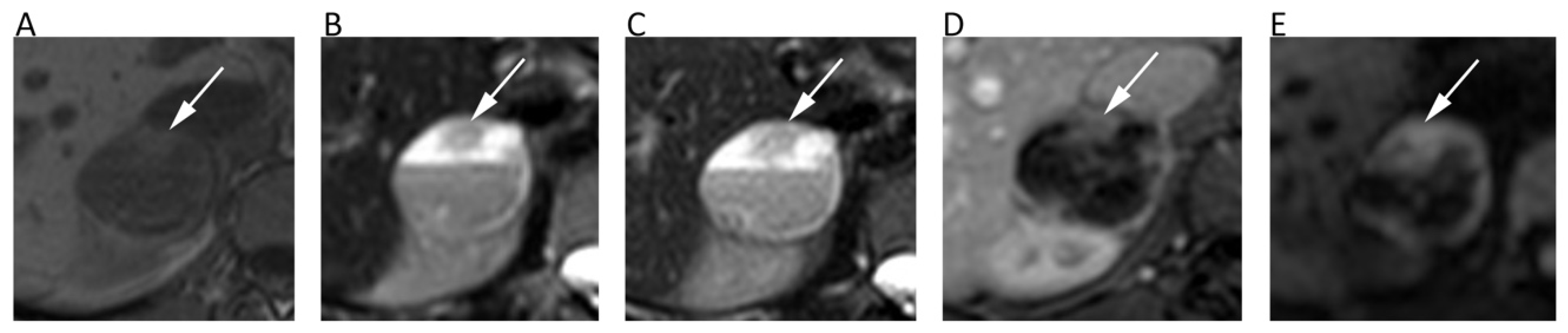 Cancers 12 01493 g009 Cancers 12 01493 g009