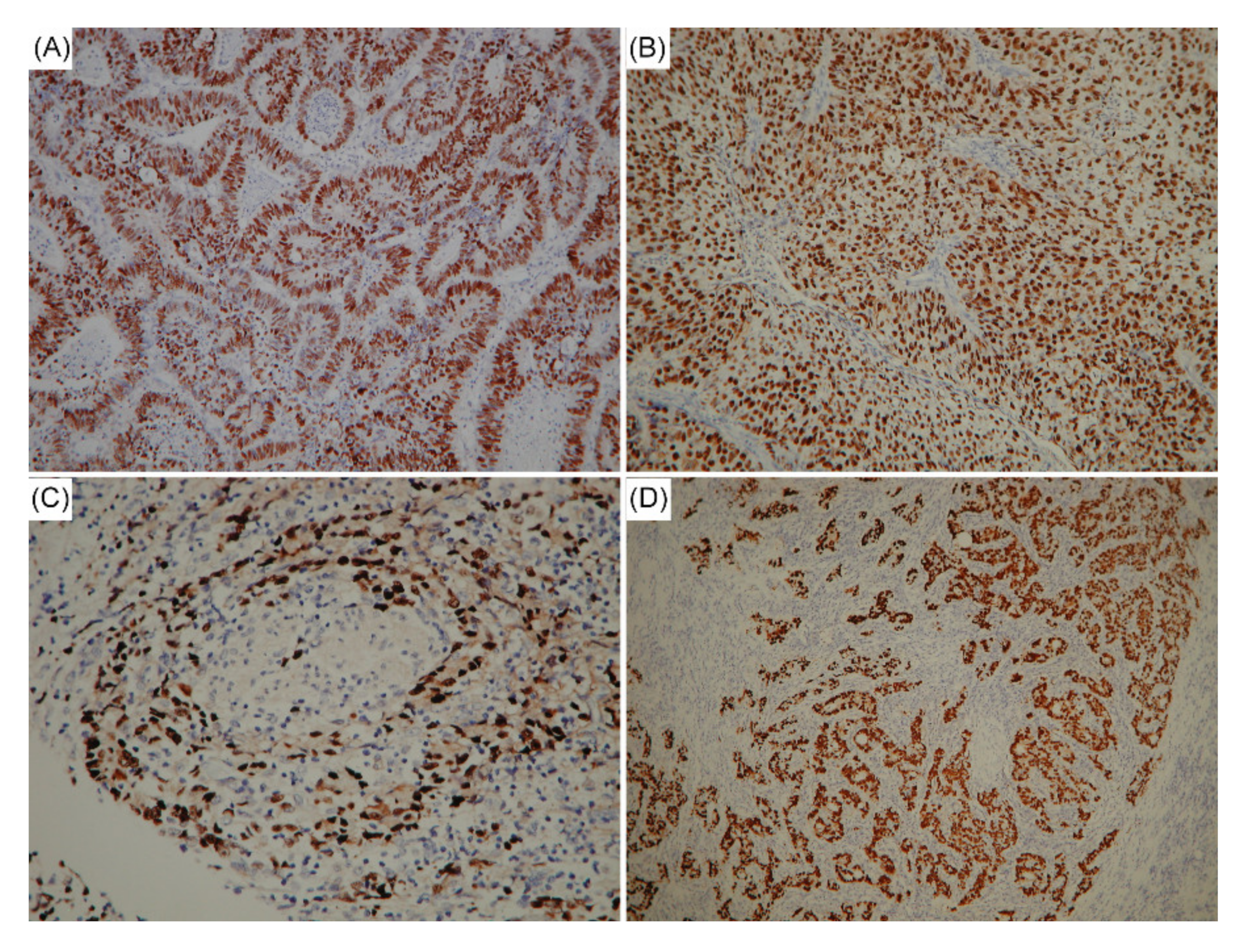 Cancers 12 01517 g001