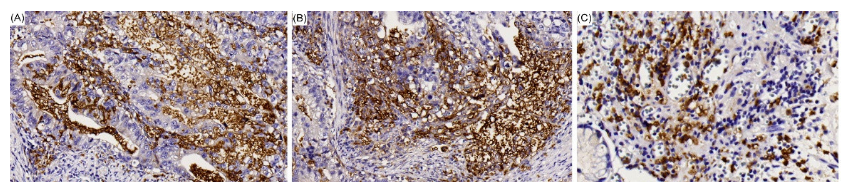 Cancers 12 01517 g002