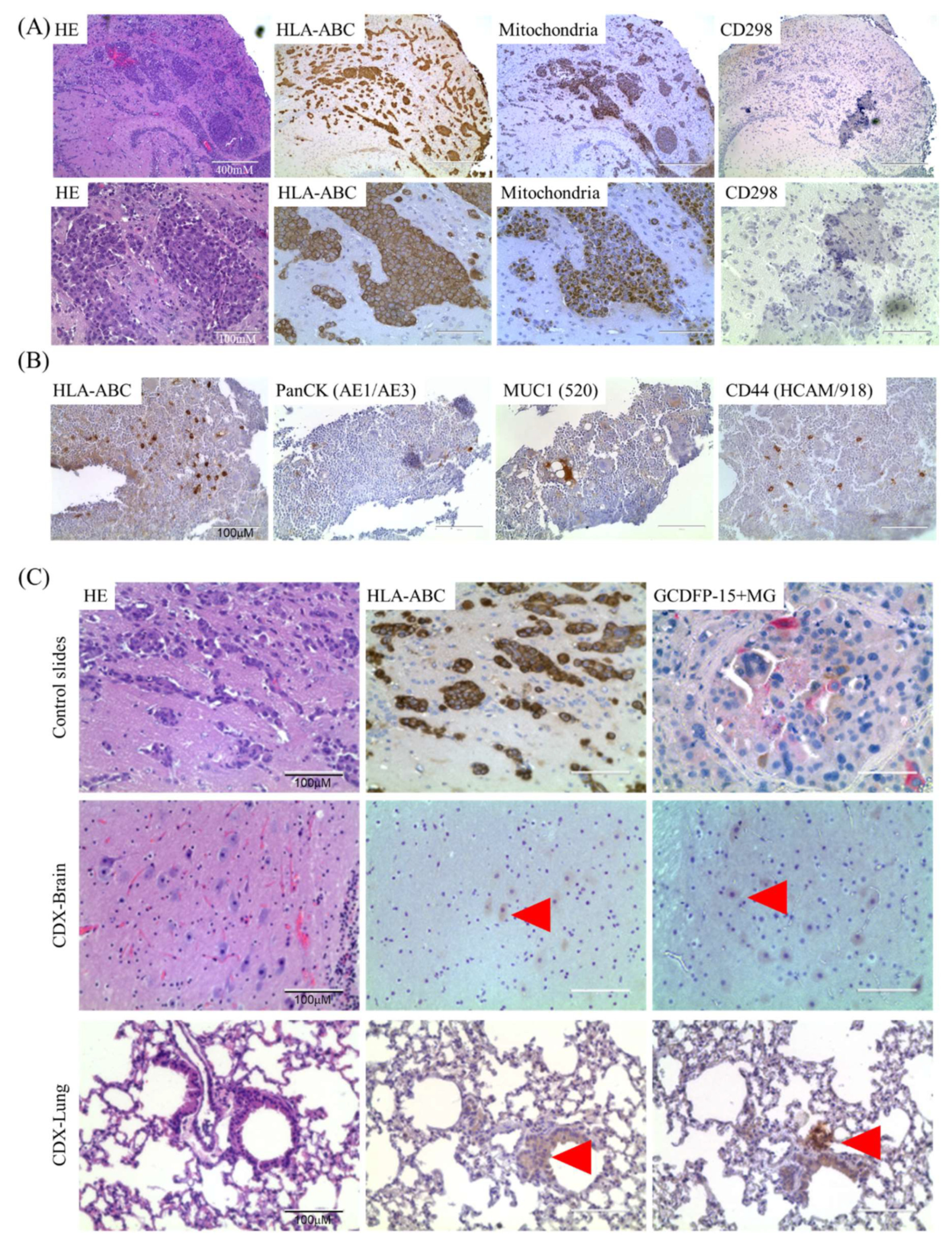 Cancers 12 01626 g003 Cancers 12 01626 g003
