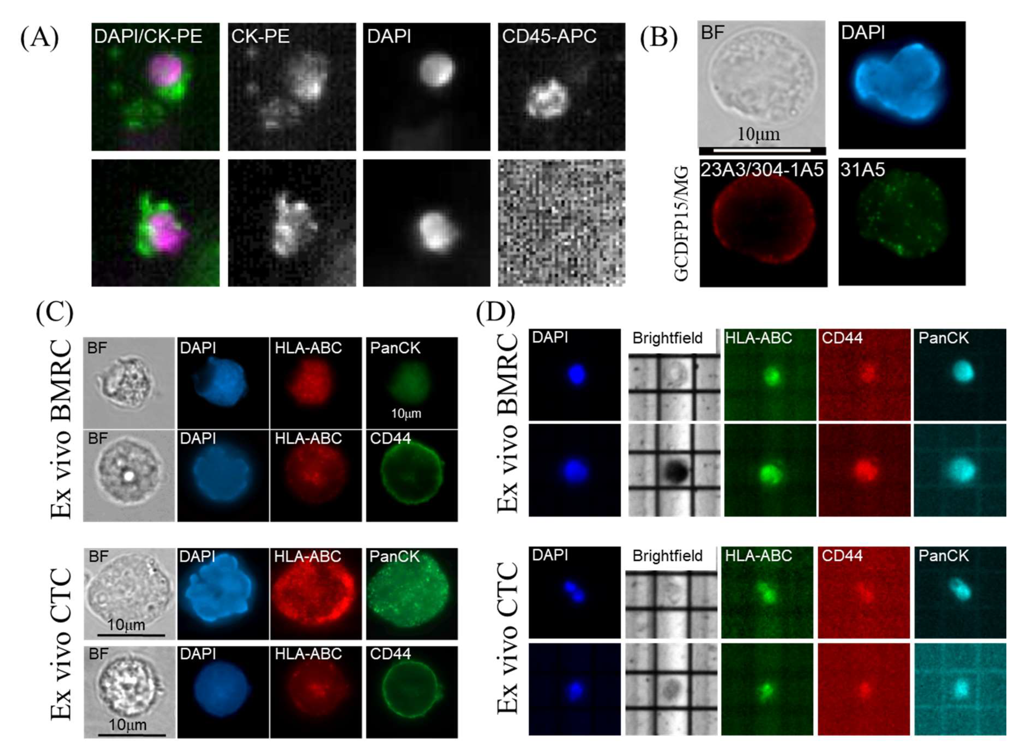 Cancers 12 01626 g004 Cancers 12 01626 g004