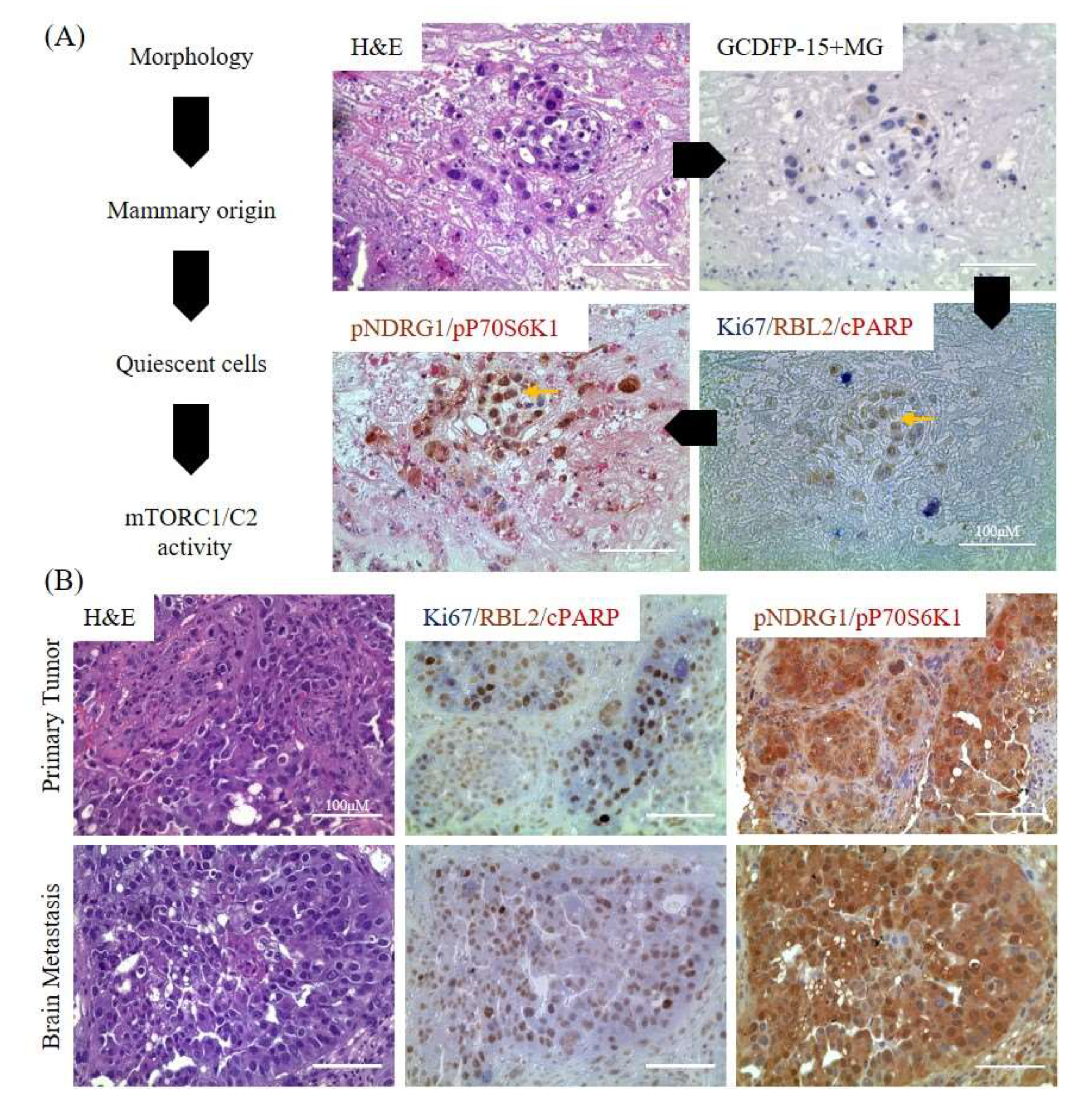 Cancers 12 01626 g006a Cancers 12 01626 g006a