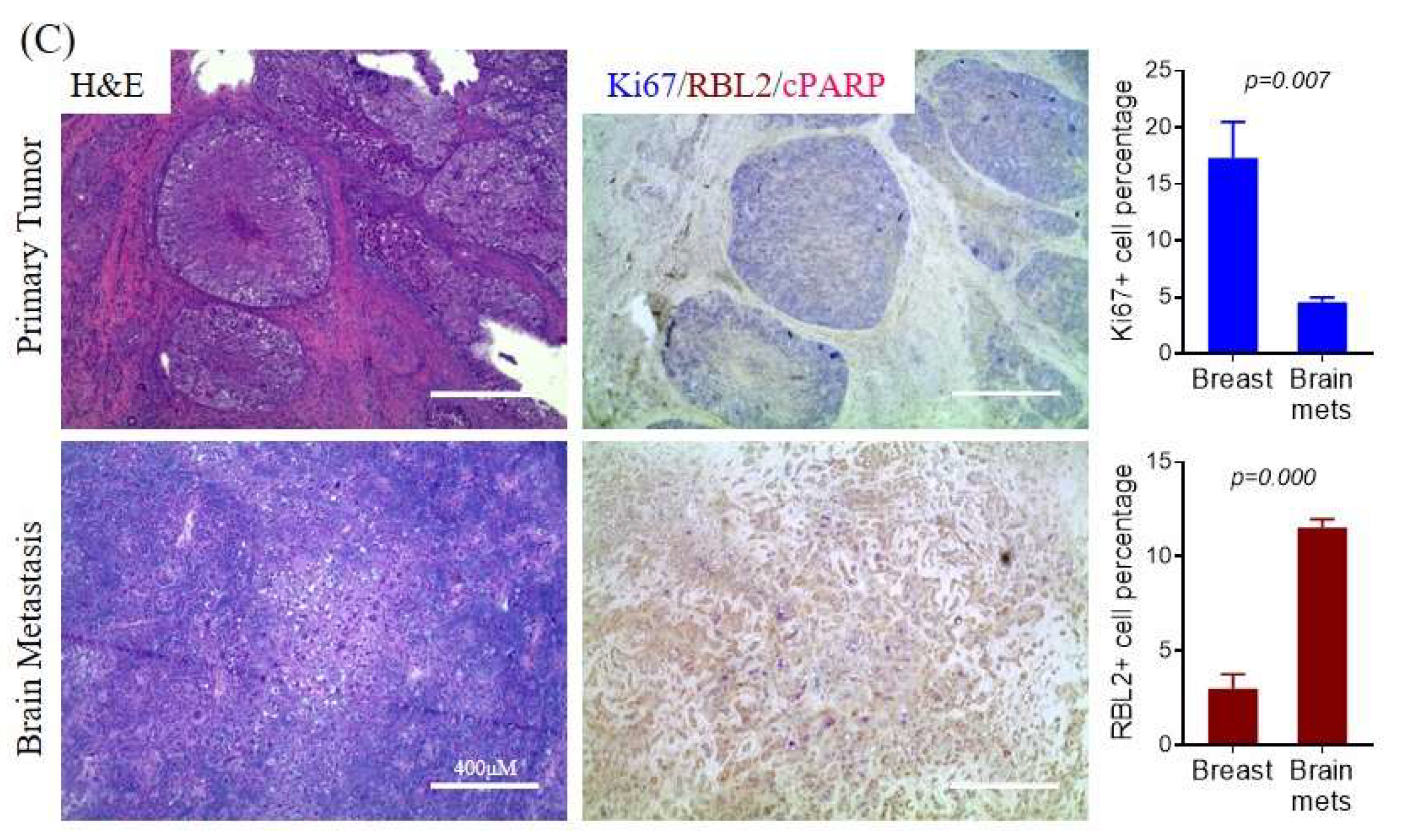 Cancers 12 01626 g006b Cancers 12 01626 g006b