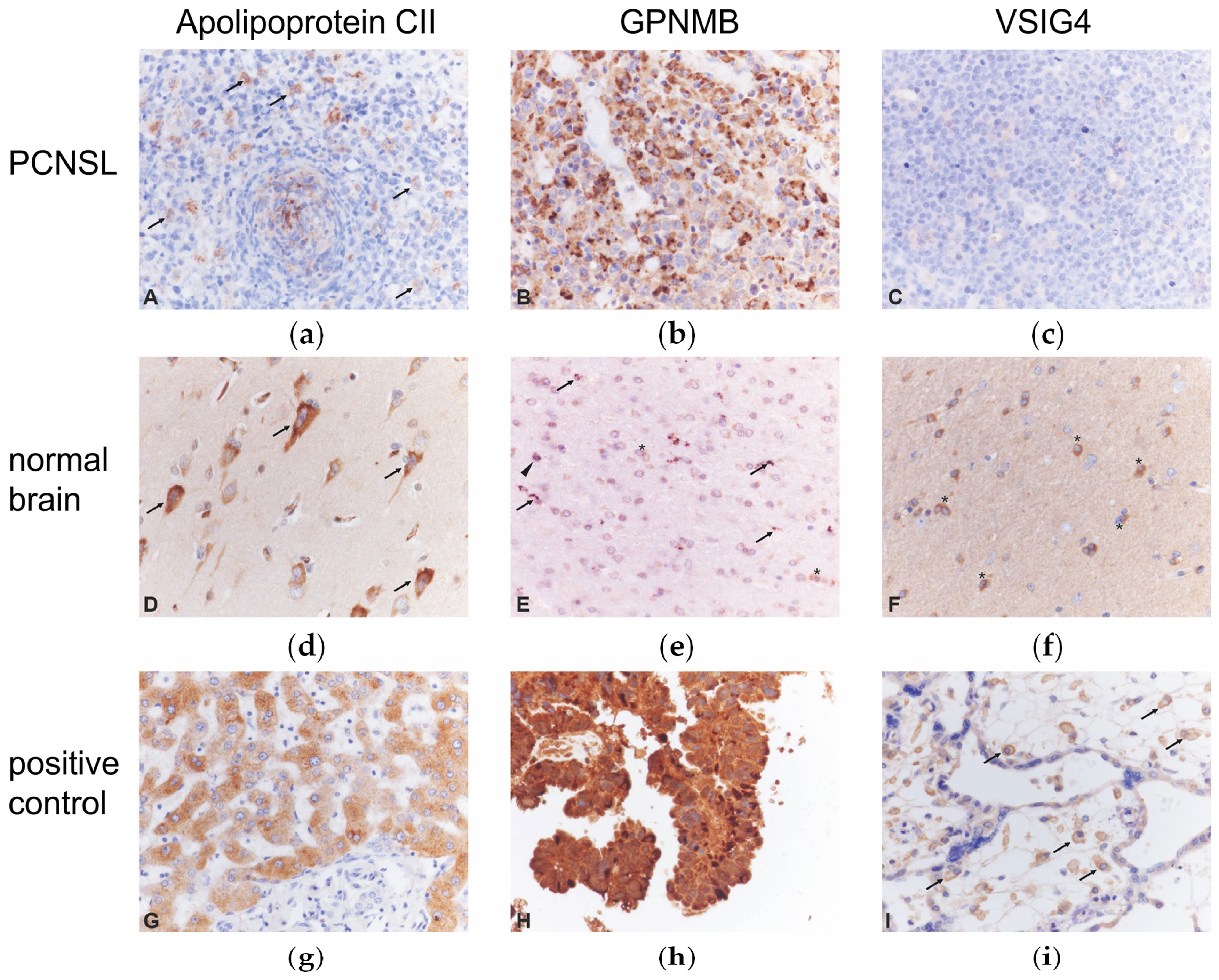 Cancers 12 01732 g005