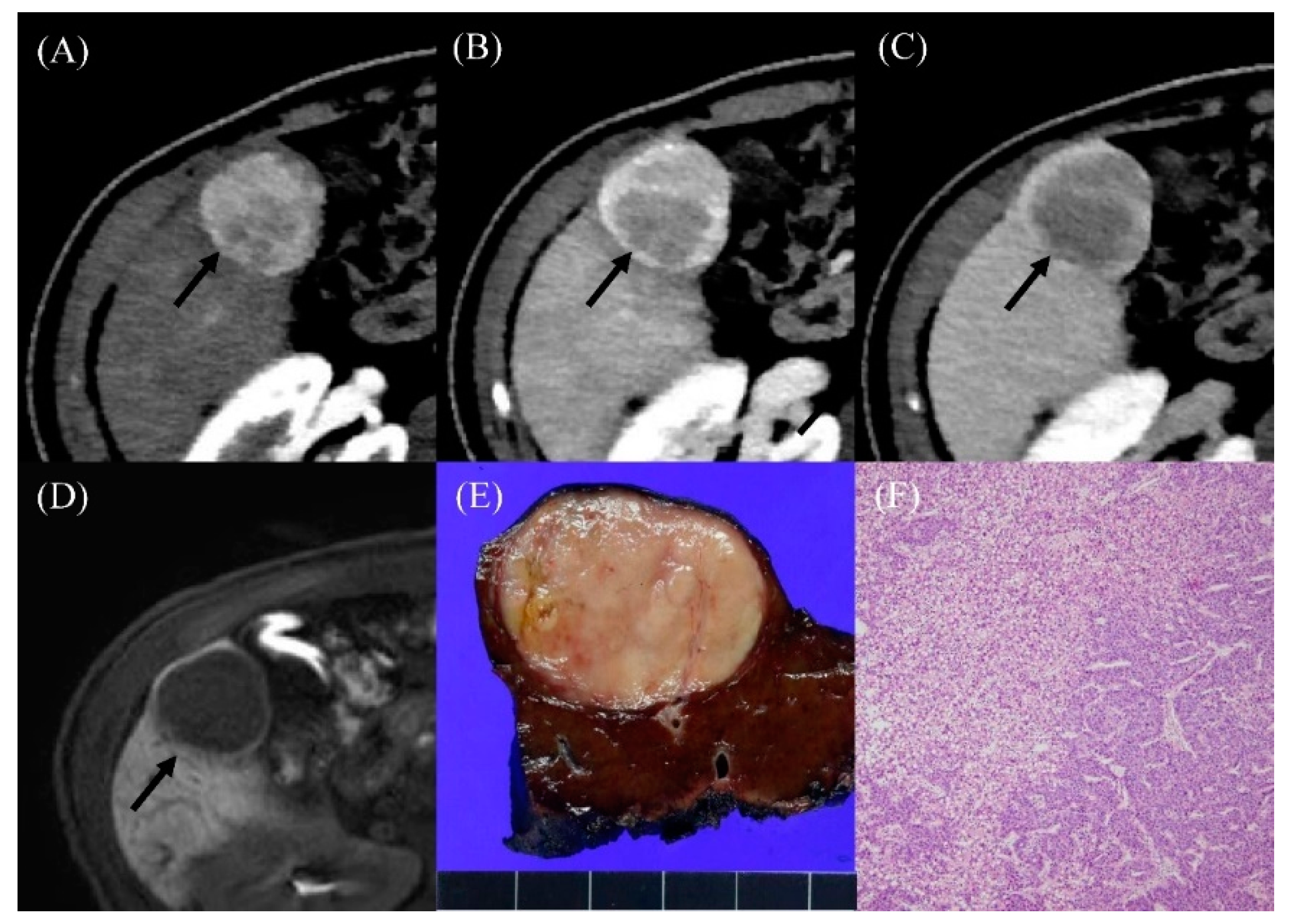 Cancers 12 01805 g002 Cancers 12 01805 g002