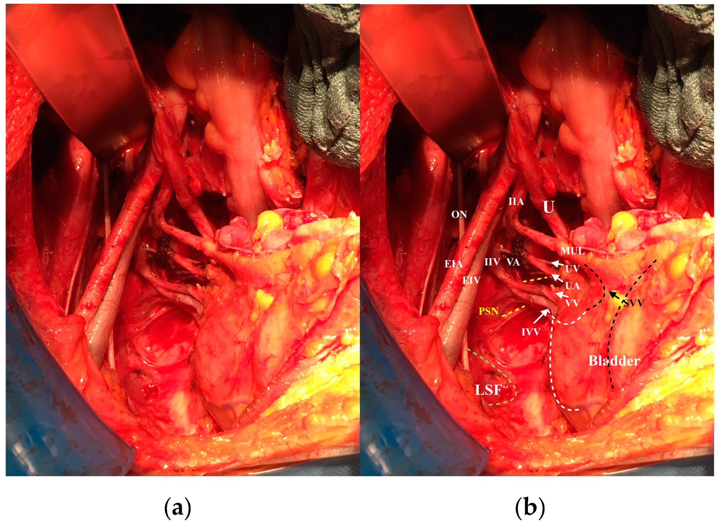 Cancers 12 01839 g001