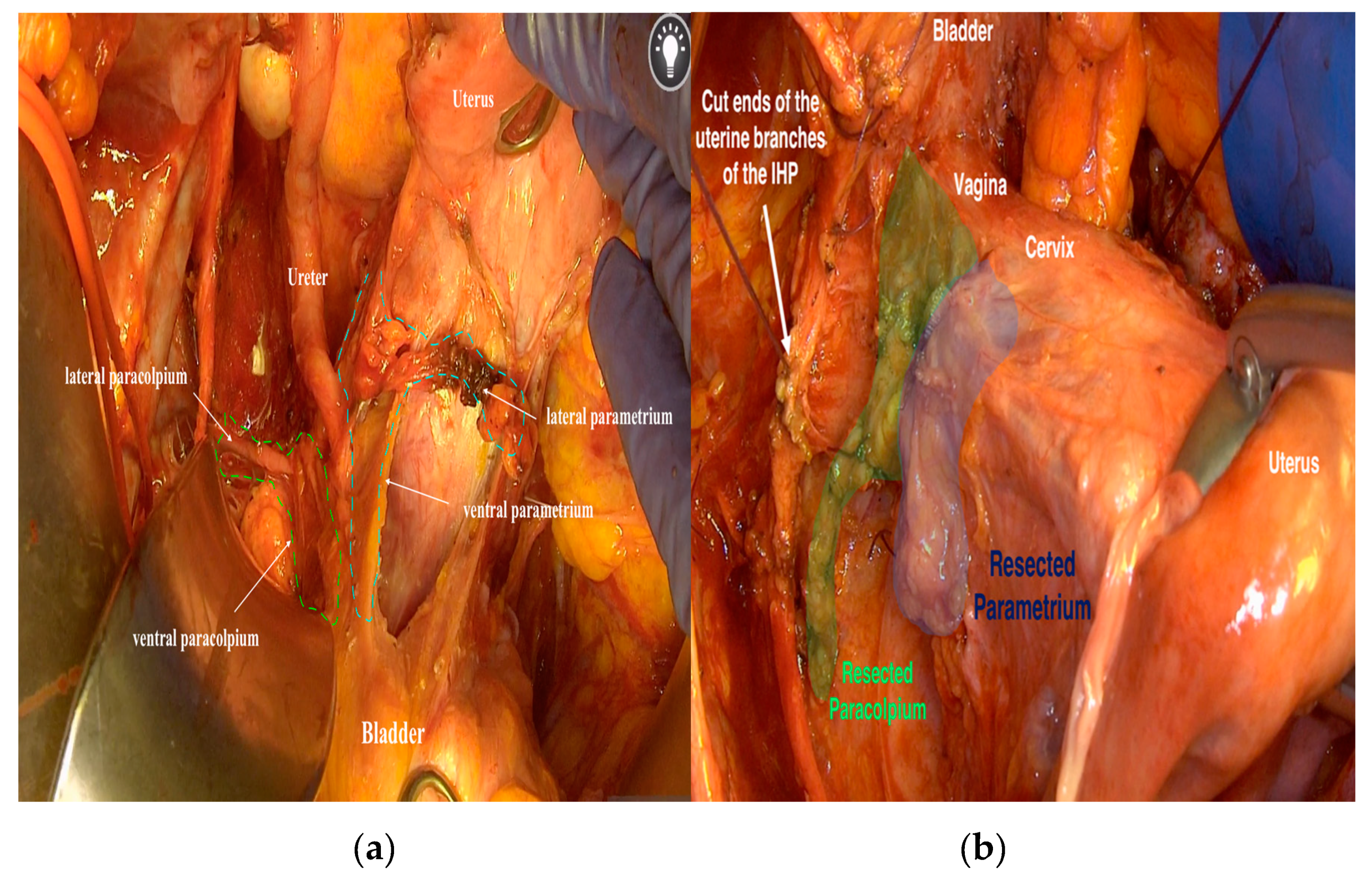 Cancers 12 01839 g002