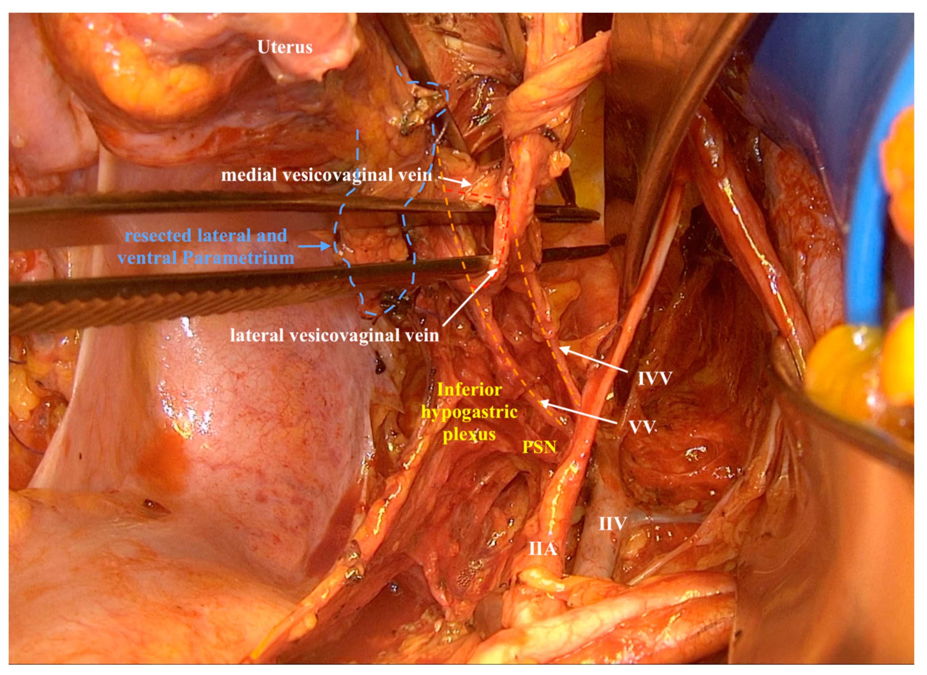 Cancers 12 01839 g003