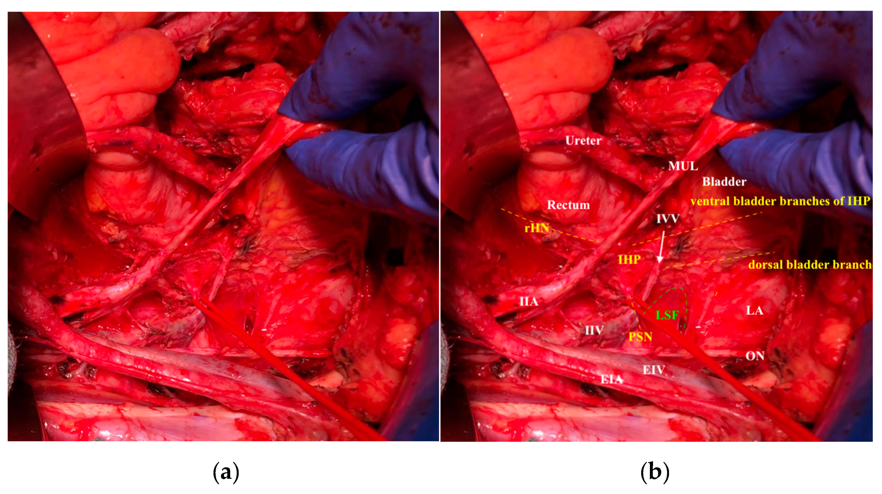 Cancers 12 01839 g004